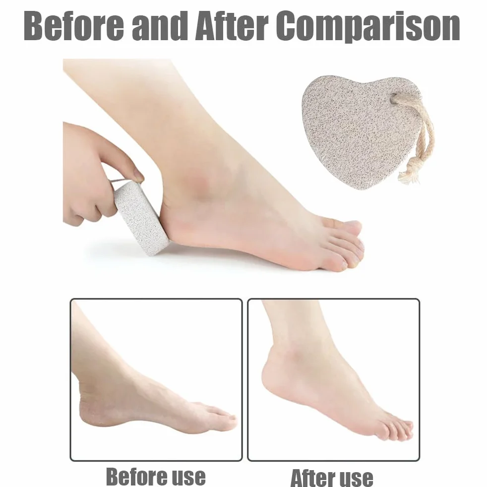 Pietra pomice naturale per piedi, strumento pedicure lava, rimozione calli pelle dura