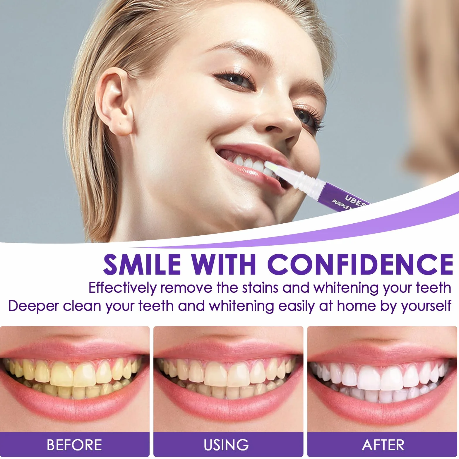 Penne Gel Sbiancante per Denti Bianchi, Sbiancamento Dentale Professionale, Rimuove Macchie e Tartaro