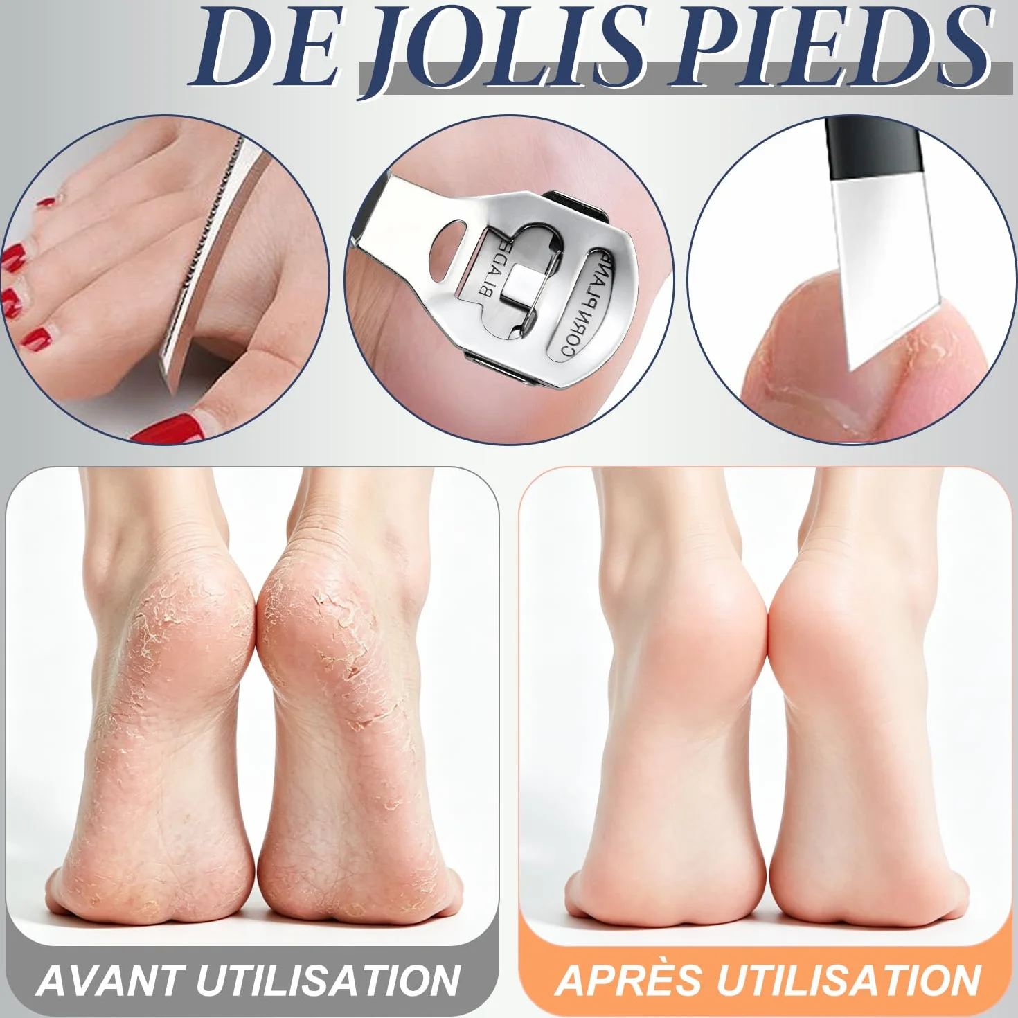 iZoeL Zestaw do Pedicure, 1 Raschietto Rasoio, 10 Lame Wymienne, Stal Nierdzewna