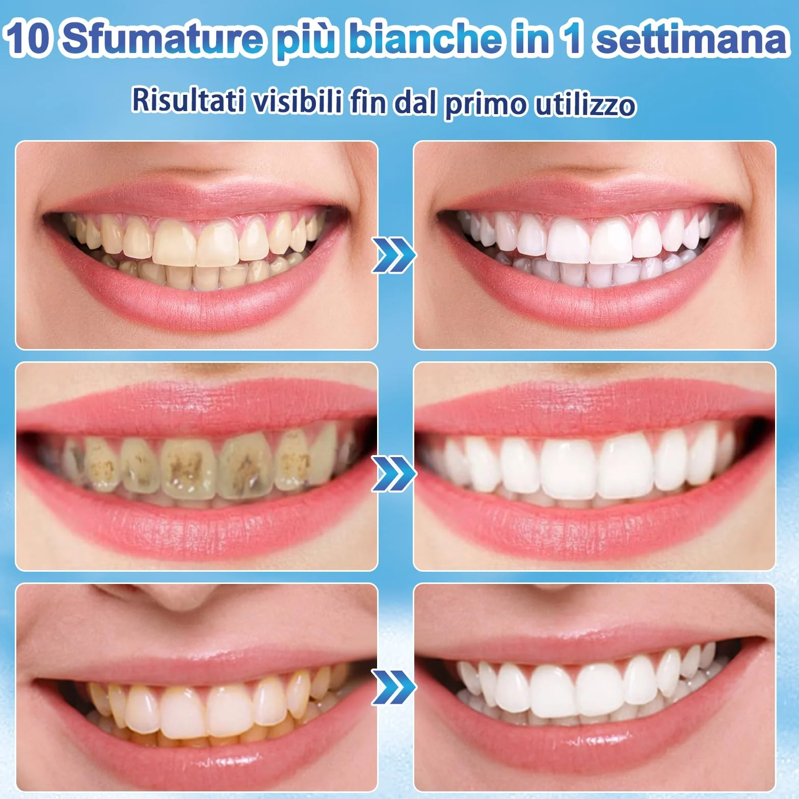 Kit Sbiancante Denti Immediato 4 Penne Gel Sbiancante Effetto Immediato