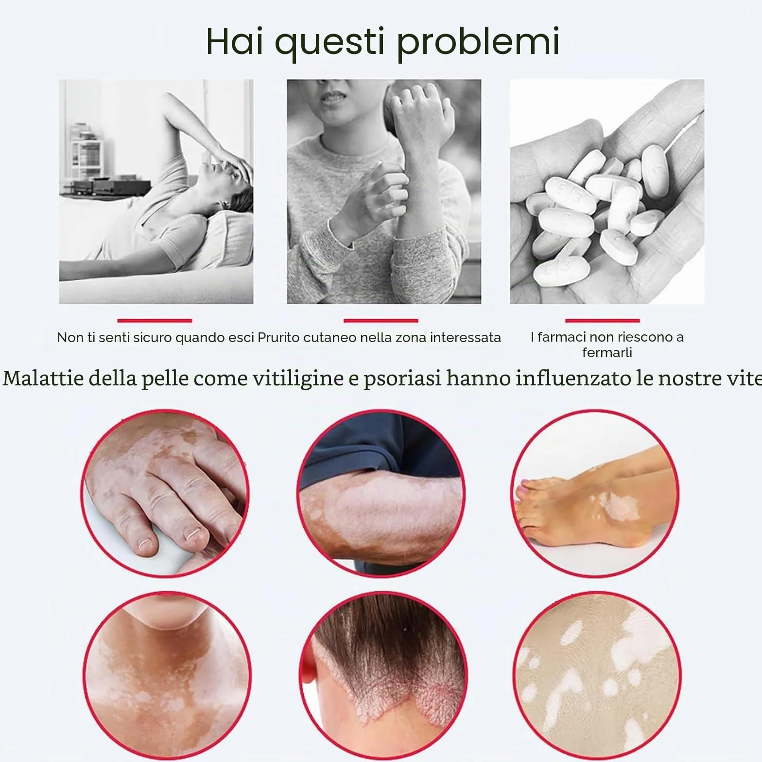 Lampada UVB per fototerapia pelle corpo 48 cm² con timer occhiali portatile