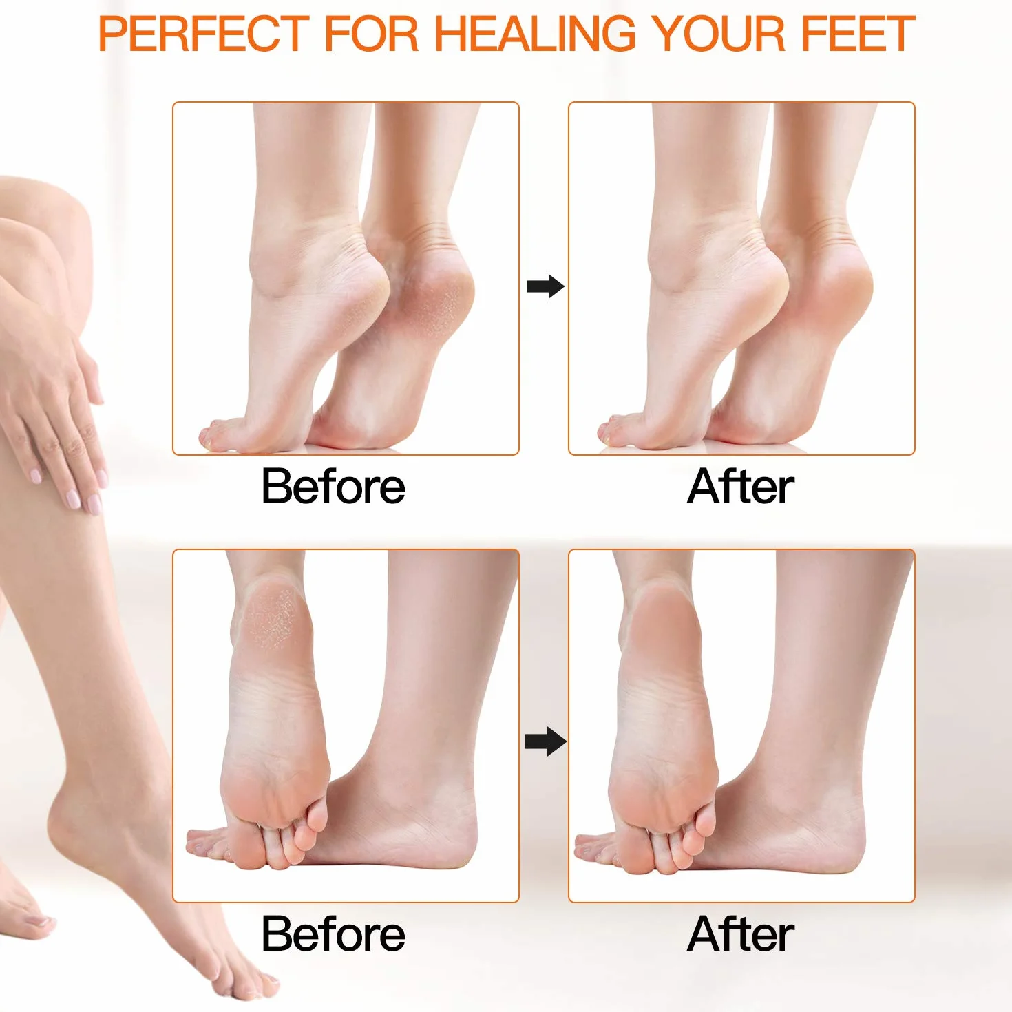 Piedi Roll Elettrico Professionale Ricaricabile 3 Ruoli 5 Livelli 1200MAH IPX7 Impermeabile 2 Velocita Calli Rimuovi Pedicure