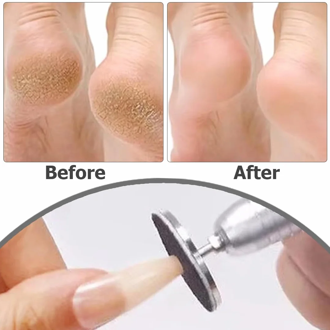 WeddHuis 60pcs Strumento per Pedicure Carta Vetrata Disco Abrasivo Pelle Morta Tacchi Screpolati 80#150#240#