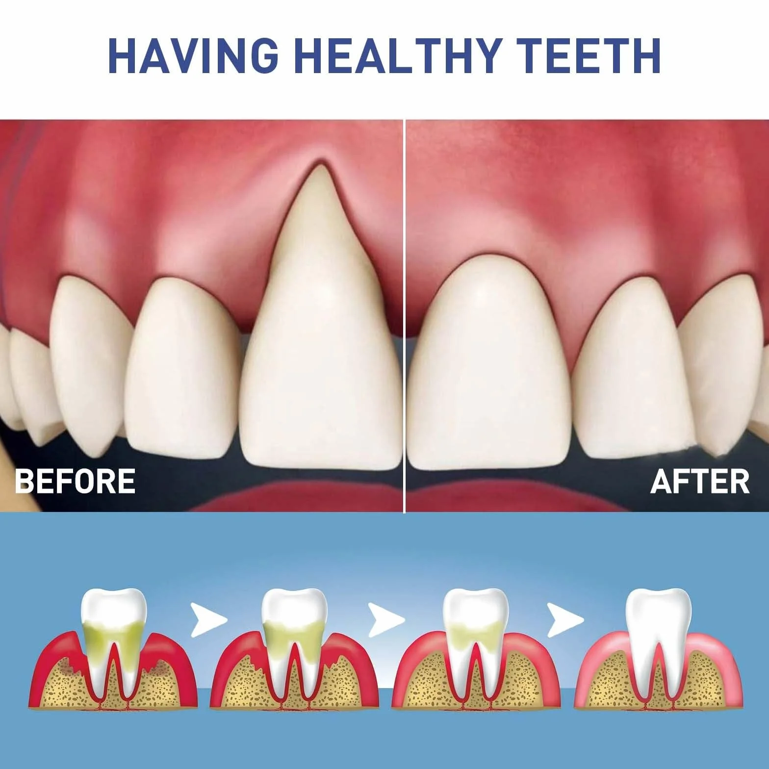 DentiZen Gum Therapy Gel - Terapia naturale delle gengive, ripristino gengive, per denti sensibili