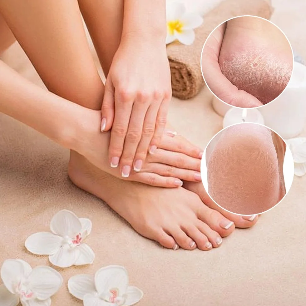 Kit per Pedicure Raschietto con 10 Lame D'argento, Callus Remover, Rimuovi Calli Piedi