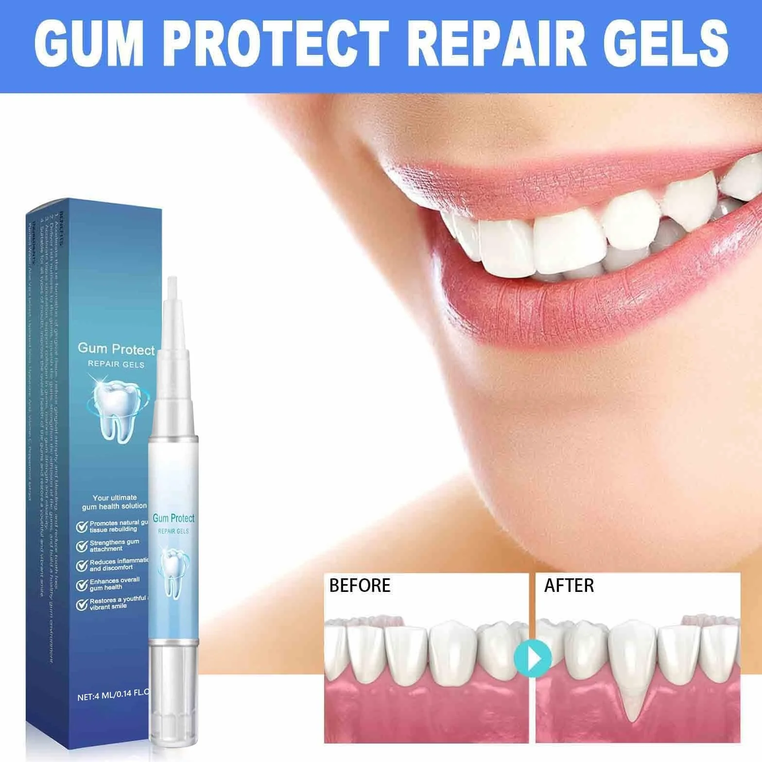 Gum Protect Repair Gel per Terapia Gengivale – Gum Shield Therapy GumSollievo Parodontale (5)