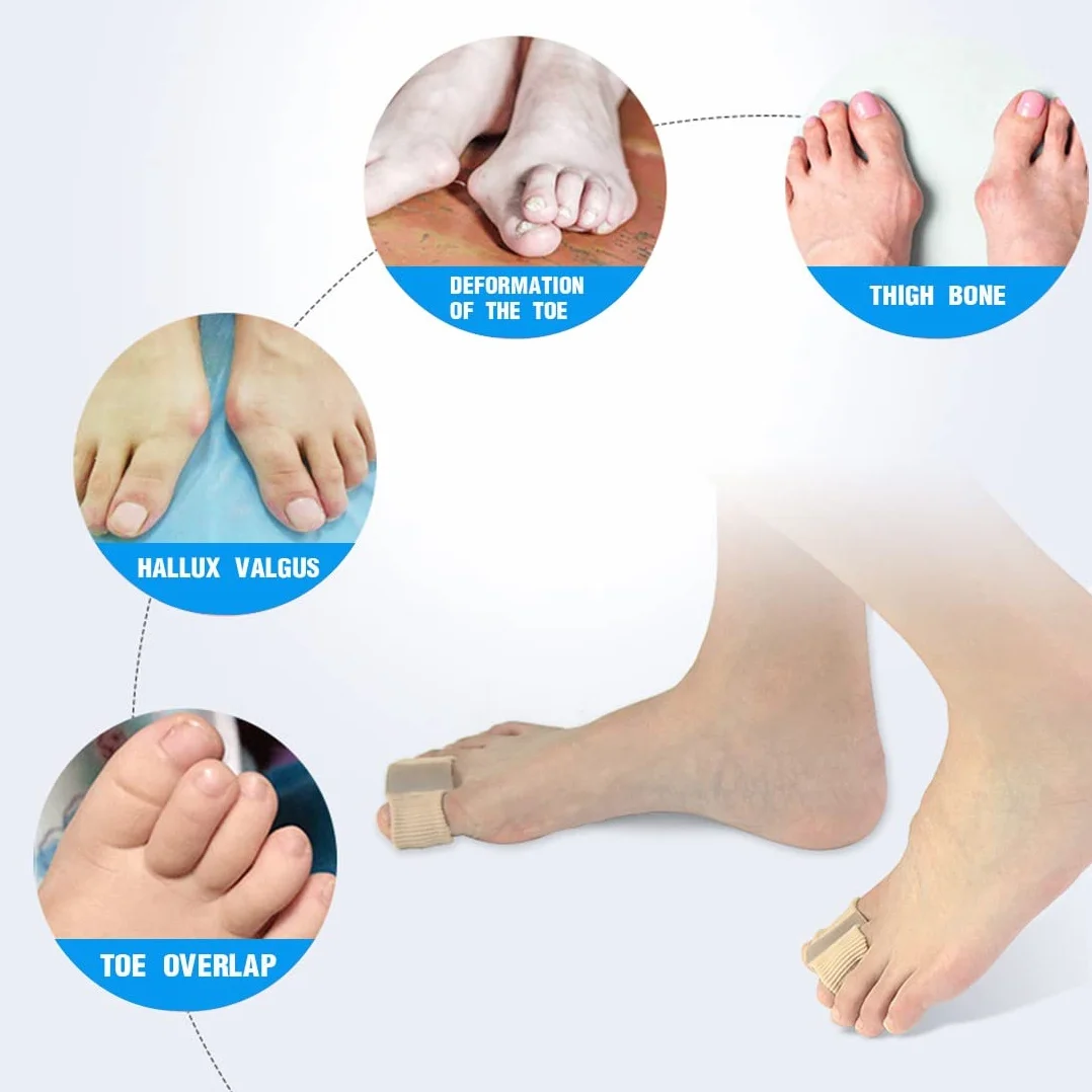 Separatori per Alluce Valgo per Dita Sovrapposte, 2Pcs Correttore in Gel per Donna Uomo