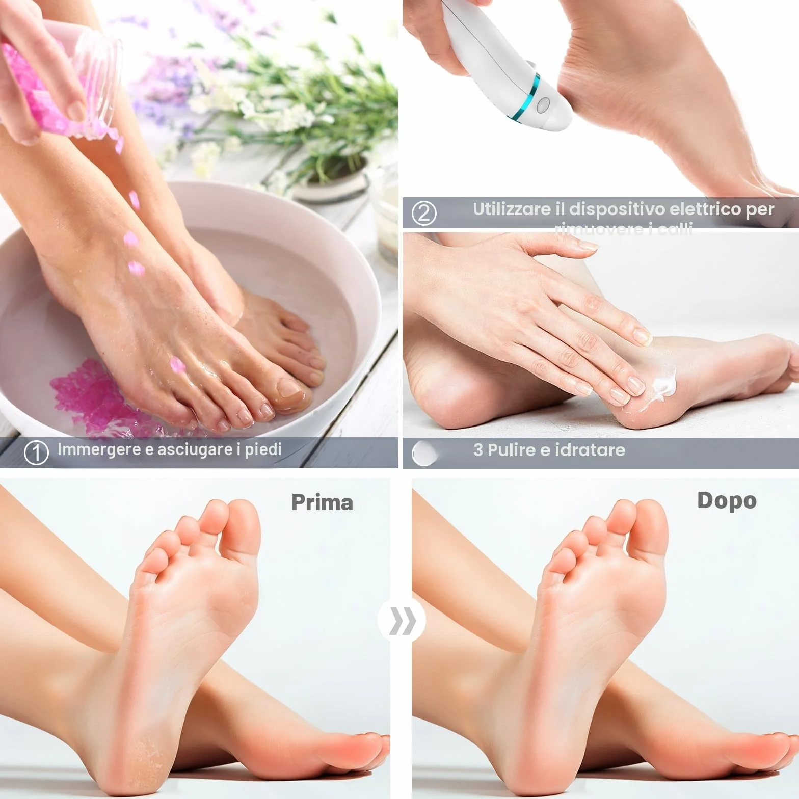 Pedicure Elettrico Professionale Ricaricabile con 3 Rulli di Ricambio, Kit Pedicure Piedi (Bianco)