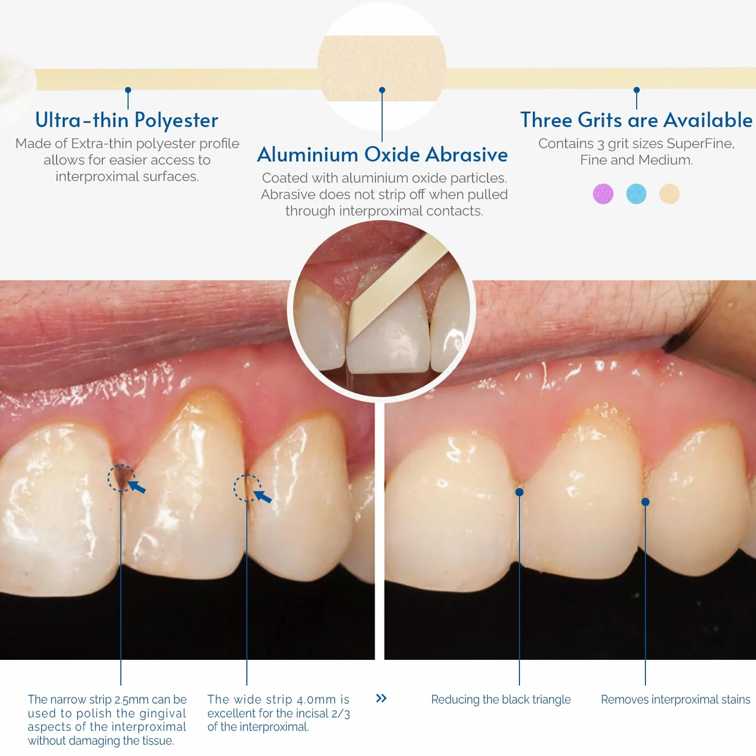 NatureAqua Carta abrasiva per denti strisce lucidatura dentale ultra-fine 4 mm 6M/rotolo