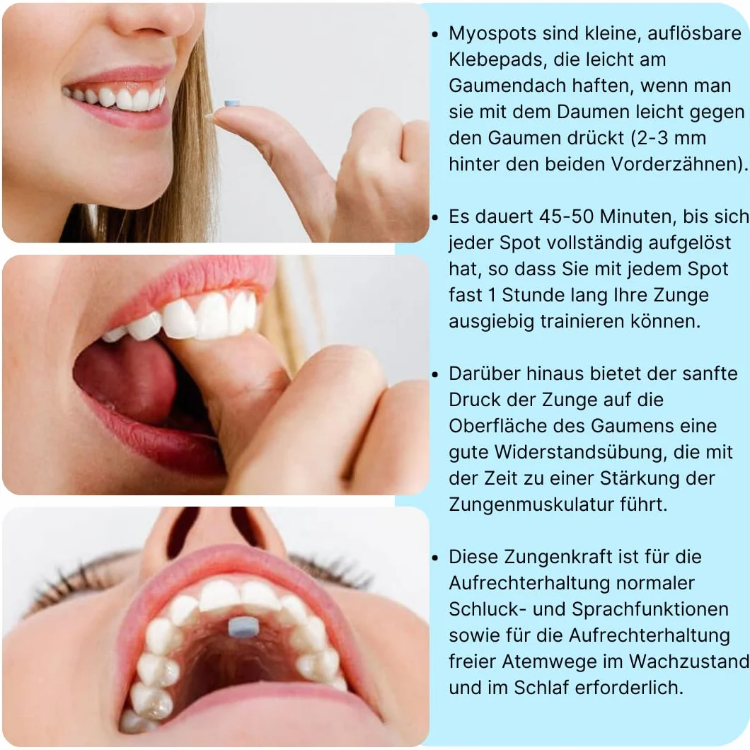 Myospots 100 compresse allenamento lingua cura respirazione salute