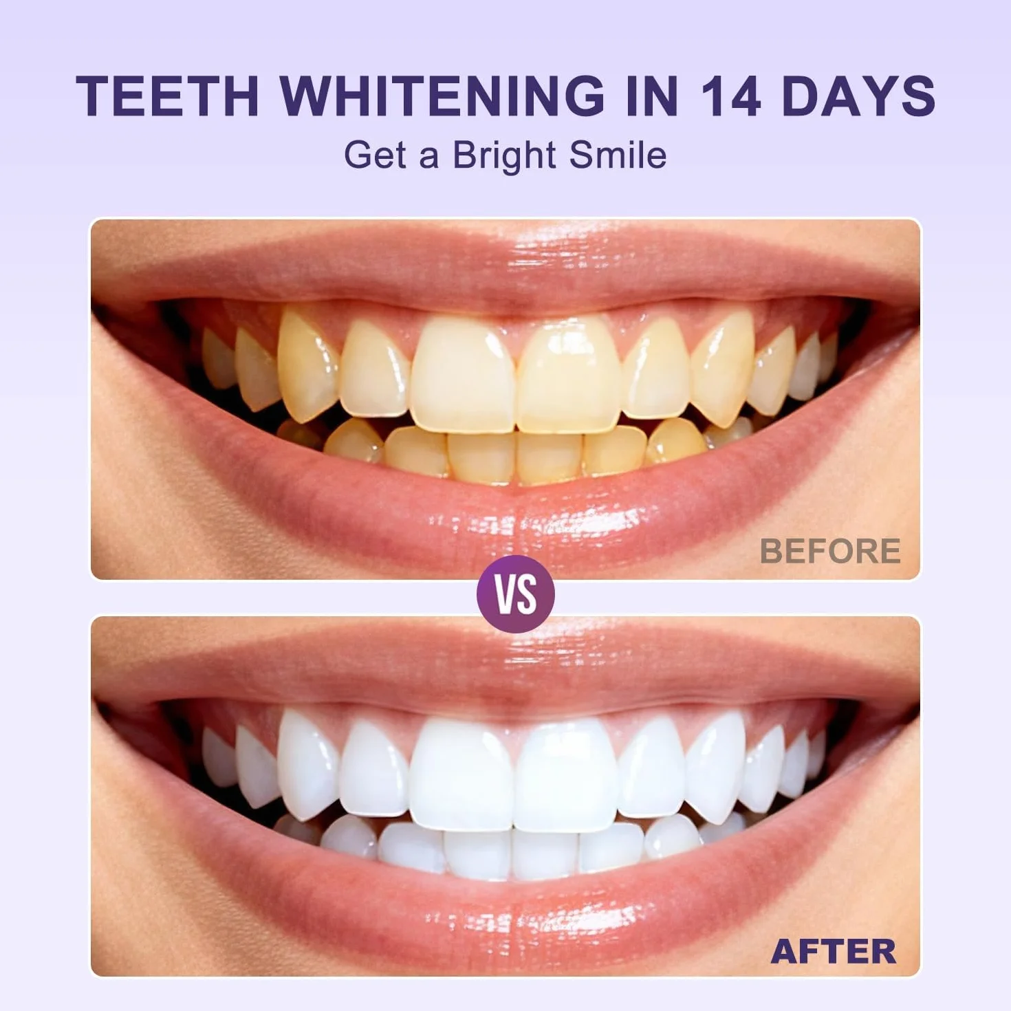 Strisce Sbiancanti Viola per Denti - Whitening Strips Senza Perossido - Risultati in 7 Giorni - 14 Pezzi