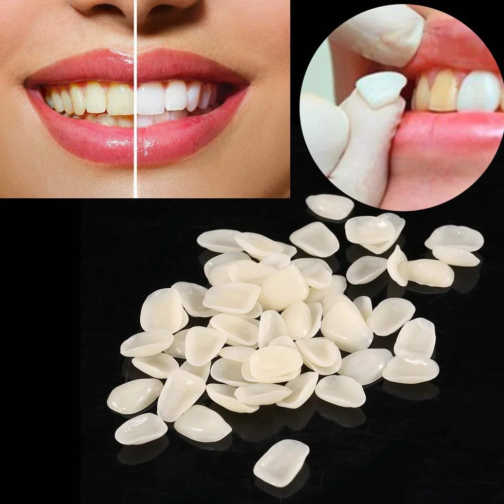 70PCS Veneer Dentali Naturale Resina Fronte Superiore Corona Temporanea Non Tossico