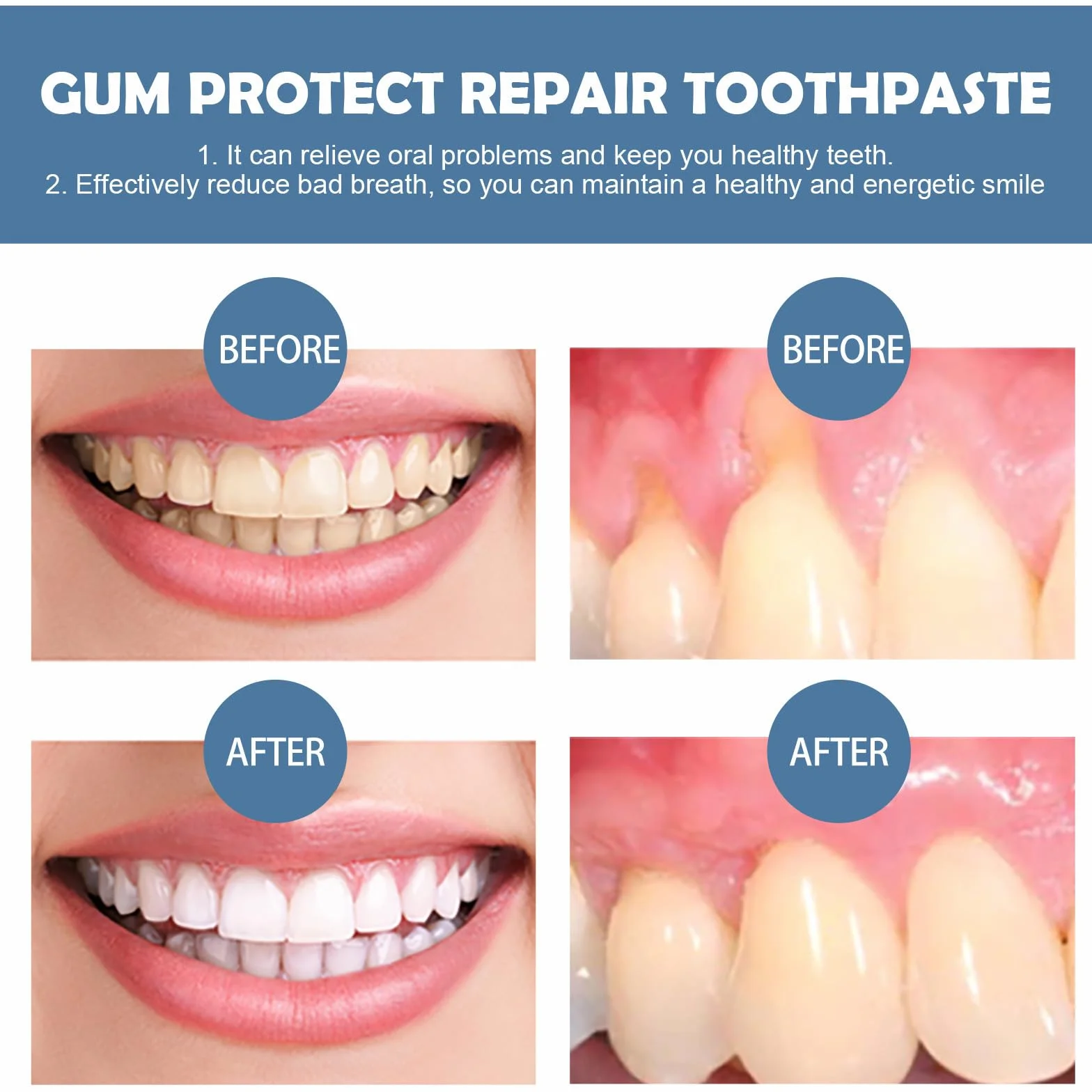 Gel per terapia gengivale Teeth Repair, riparazione recessioni gengivali, respiro fresco, pulizia profonda gengive, Protect Gums Oral Care