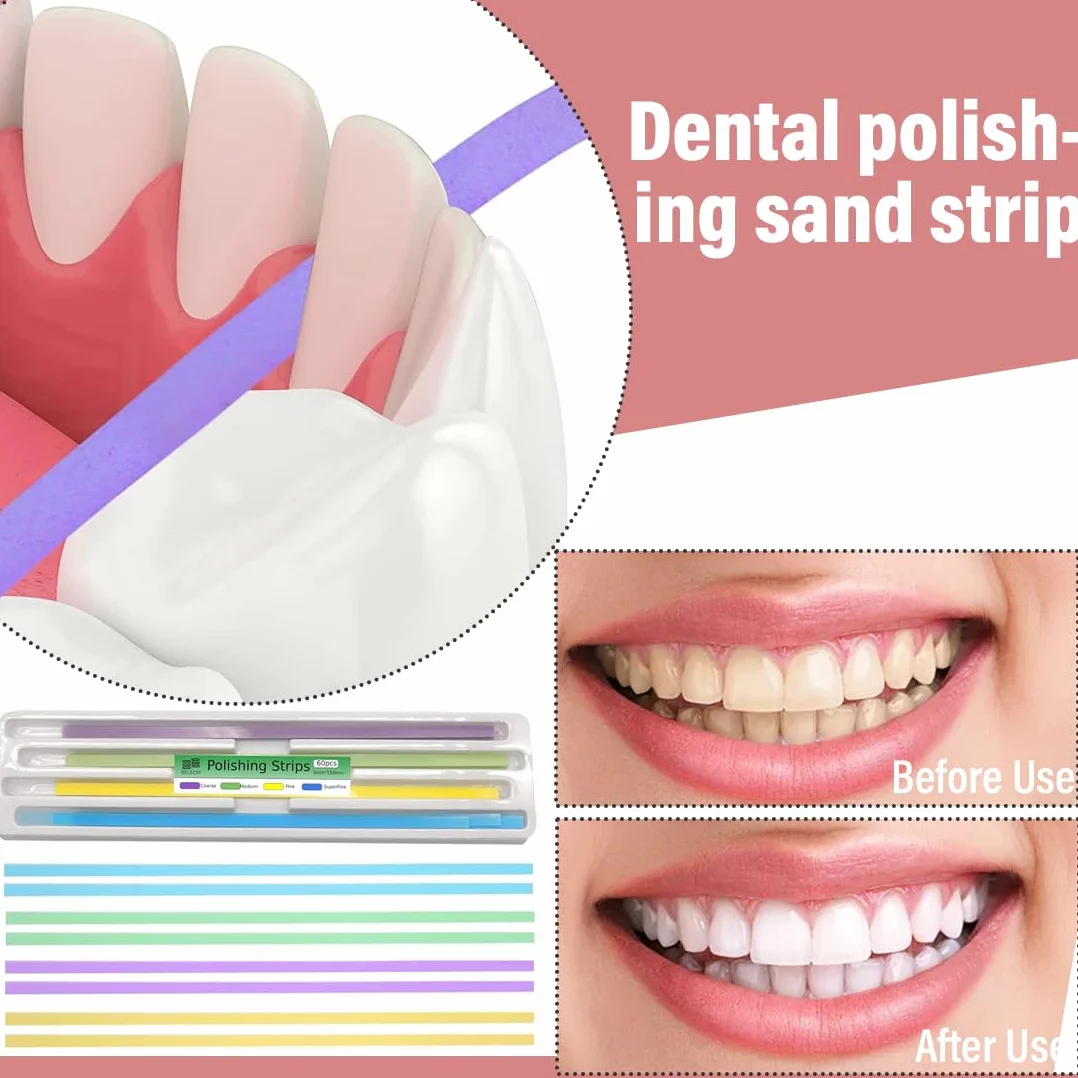 Carta Abrasiva Dentale 60 Pezzi per Spazi Vuoti, Strisce Sbiancanti e Lucidanti per Denti