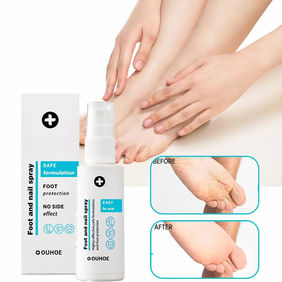 Spray Per Piedi E Unghie 2 Pcs Trattamento Del Piede Cura Dei Piedi 30ml