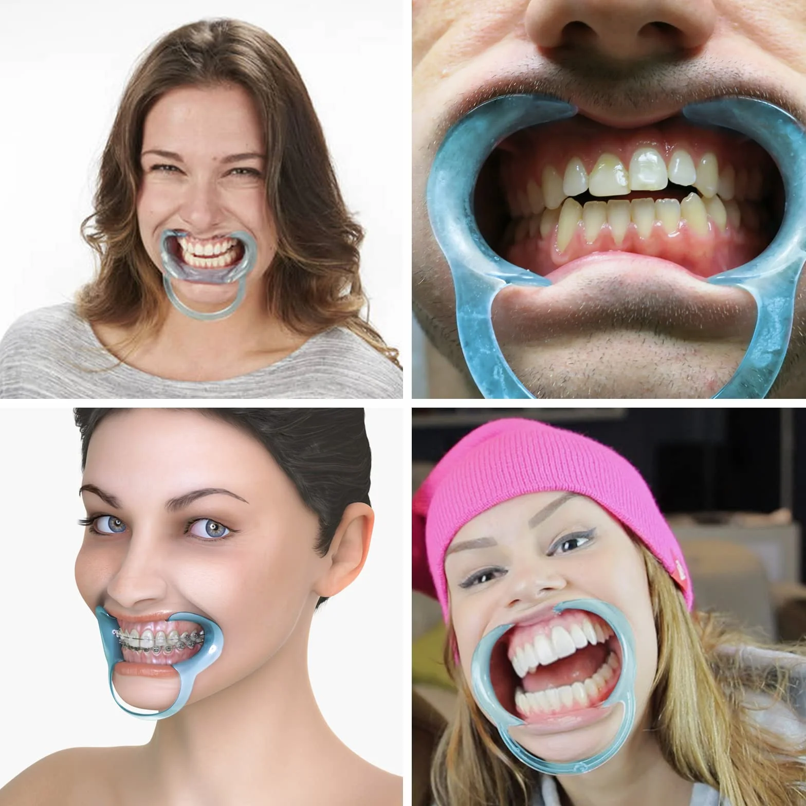 VEGCOO 18 Pz Apribocca Divaricatori Dentali in Plastica, Apri Bocca per Sbiancamento Denti, 3 Size