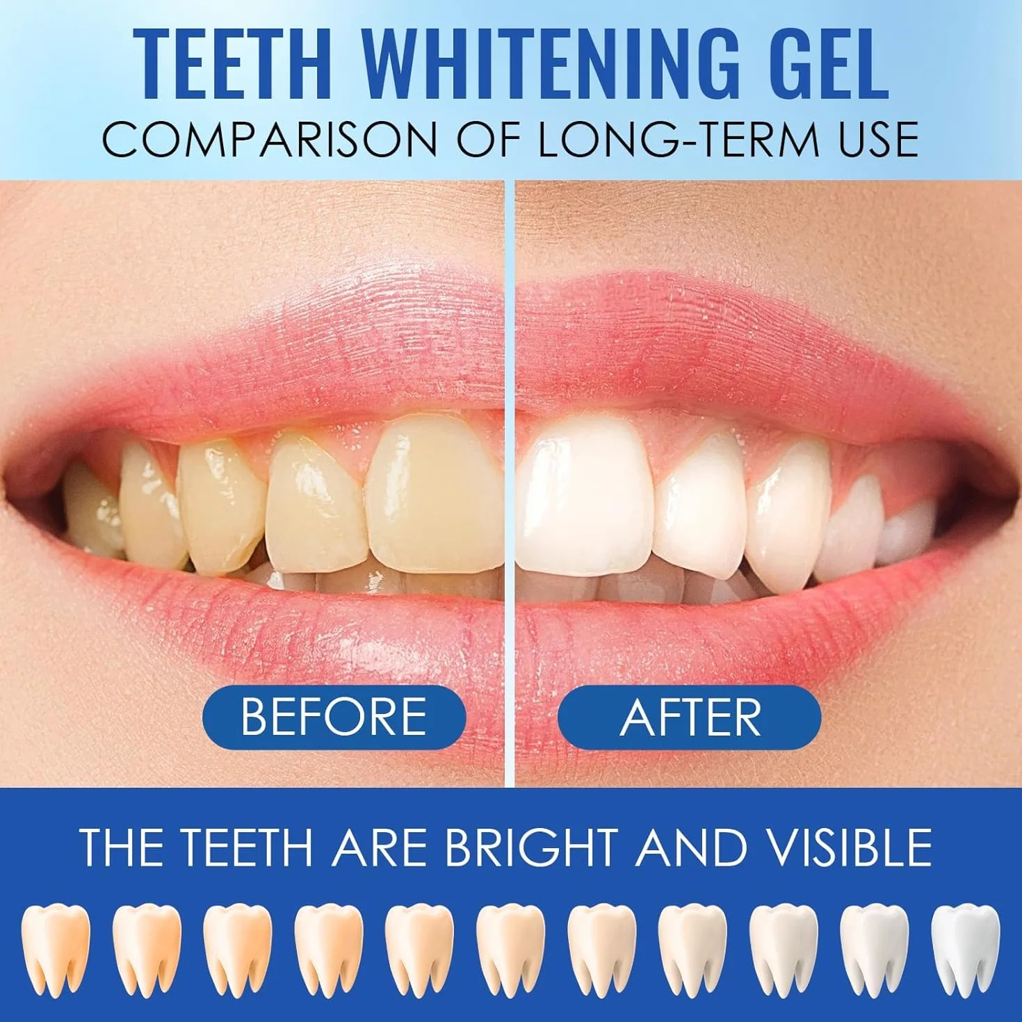 Gel Sbiancante Denti Professionale 10 Ricariche da 3 ml - Sbiancare i Denti Velocemente