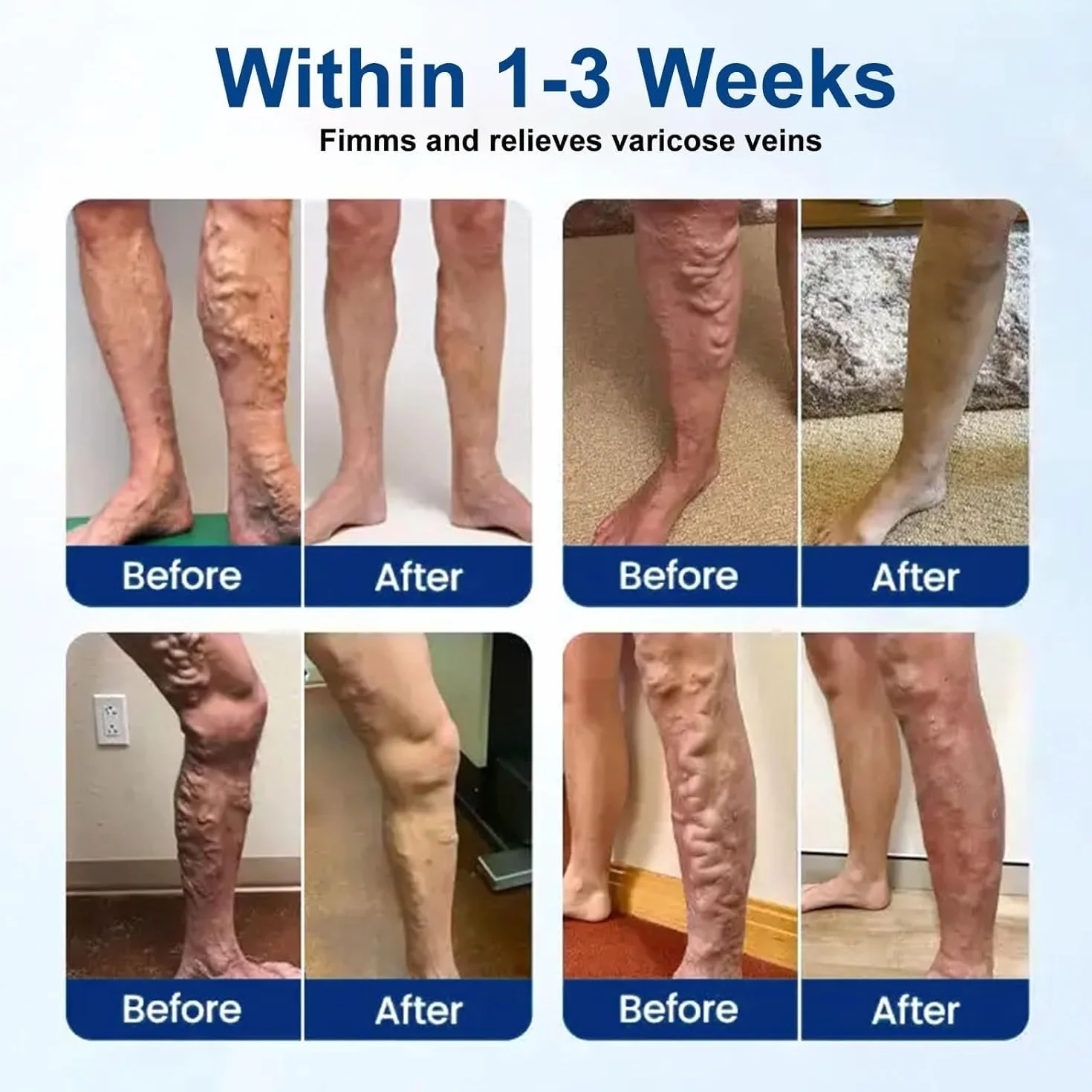 Moon Rind VeinTarget Microdarts 12 Patch Care patch per alleviare il disagio alle gambe