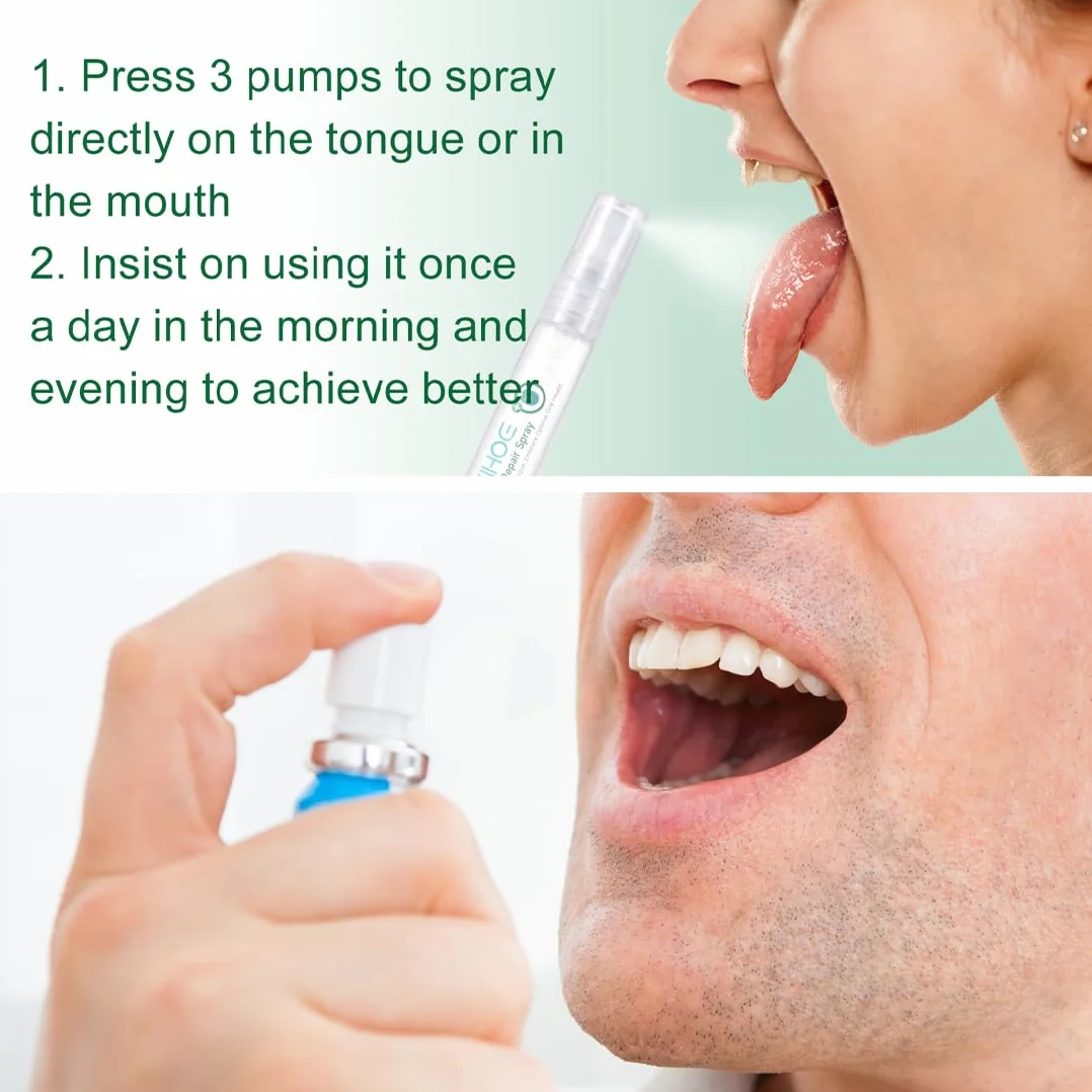 Spray Per Alleviare La Lingua Fessurata 30ml Riduce Il Gonfiore Trattamento Alitosi