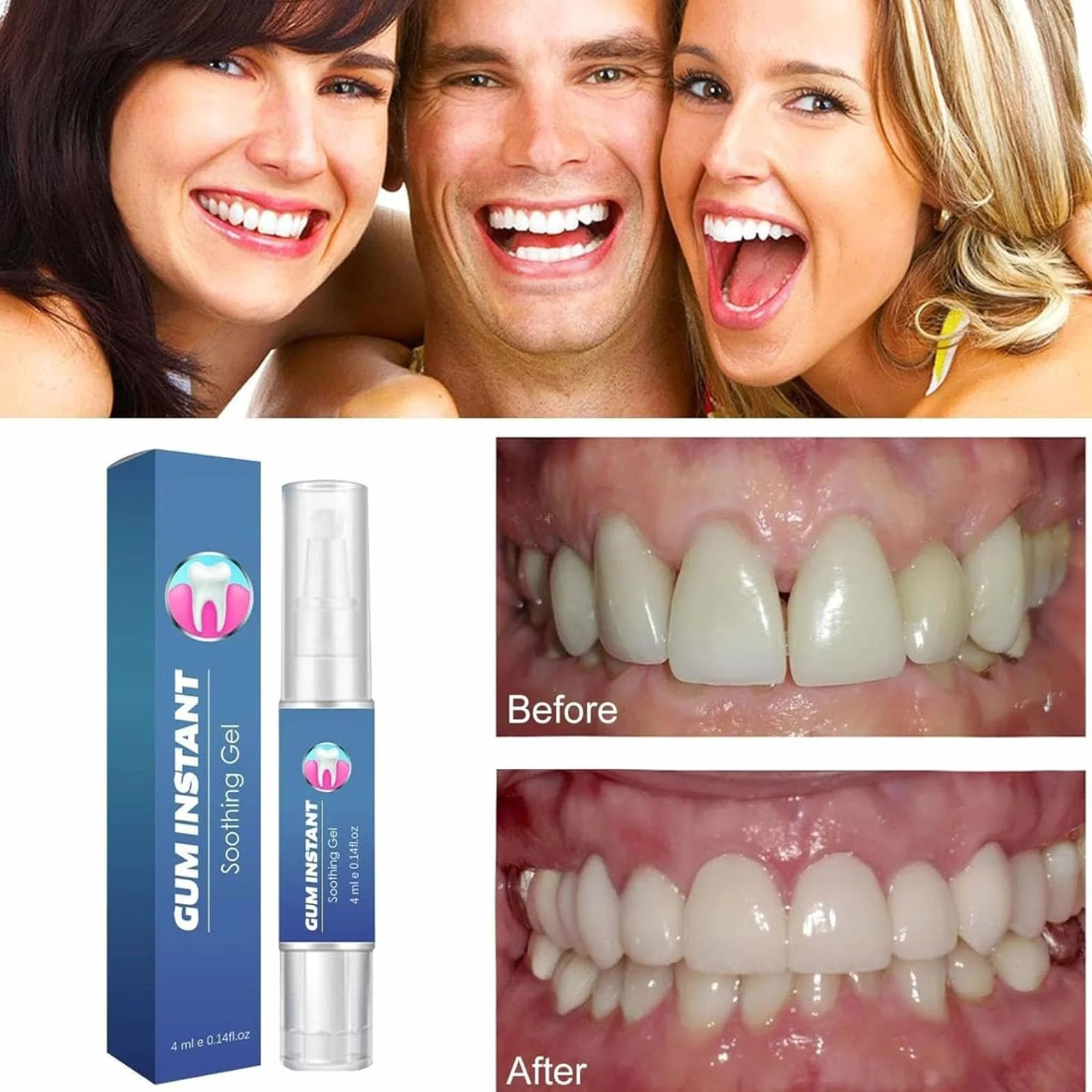 GumEase Gum Gel riparazione denti gengive lenitivo istantaneo penna essenza alito fresco igiene orale
