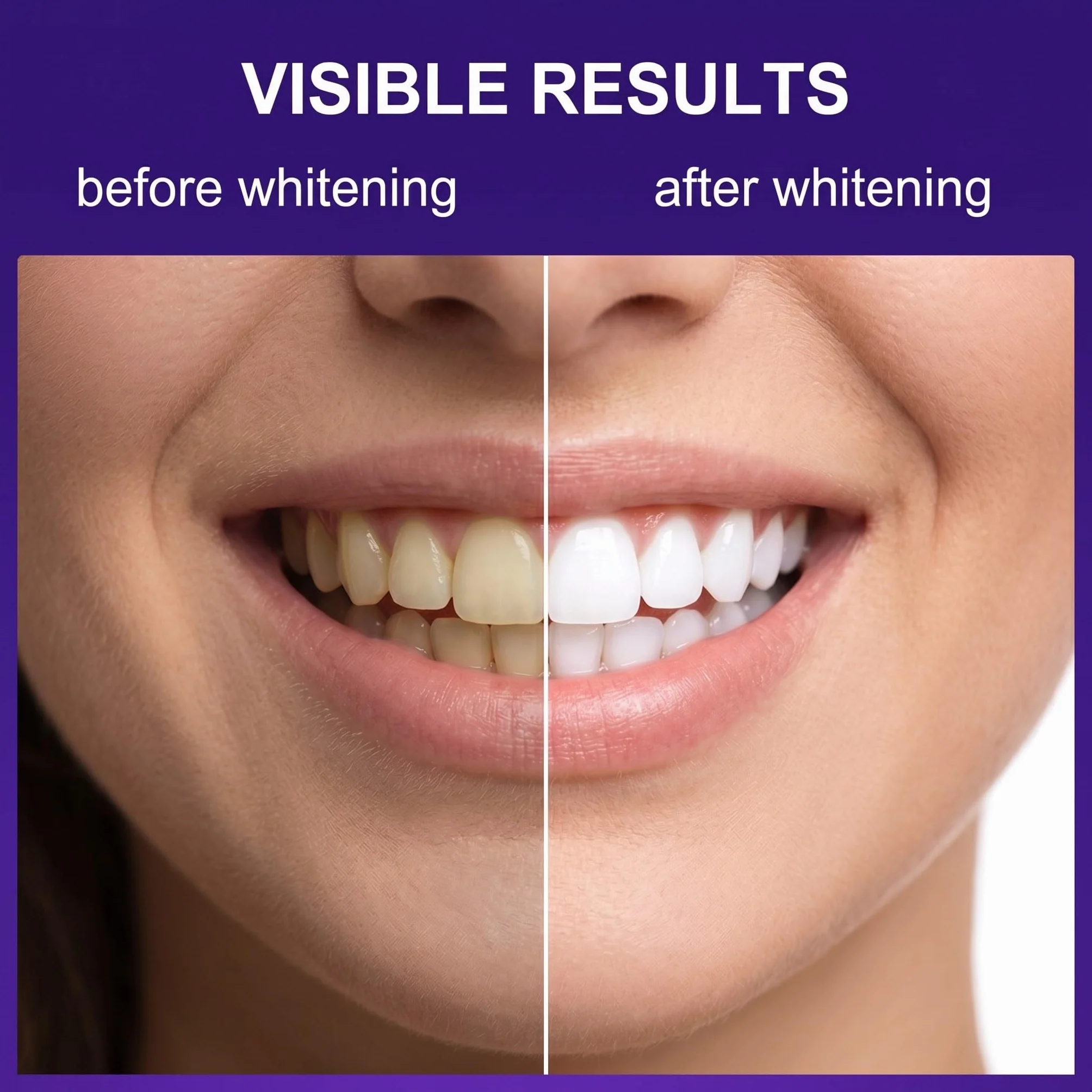 Strisce sbiancanti viola per denti, 14 pezzi, trattamento casalingo con aderenza flessibile