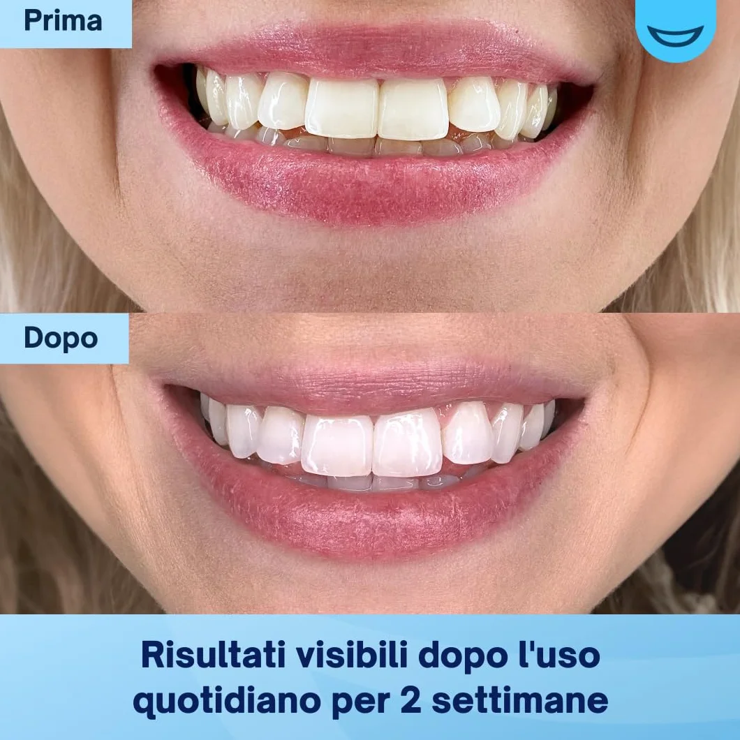 MySweetSmile Polvere Sbiancante per Denti - Approvata dai Dentisti - Sicura per lo Smalto - Gusto Menta - Fornitura 6 Mesi
