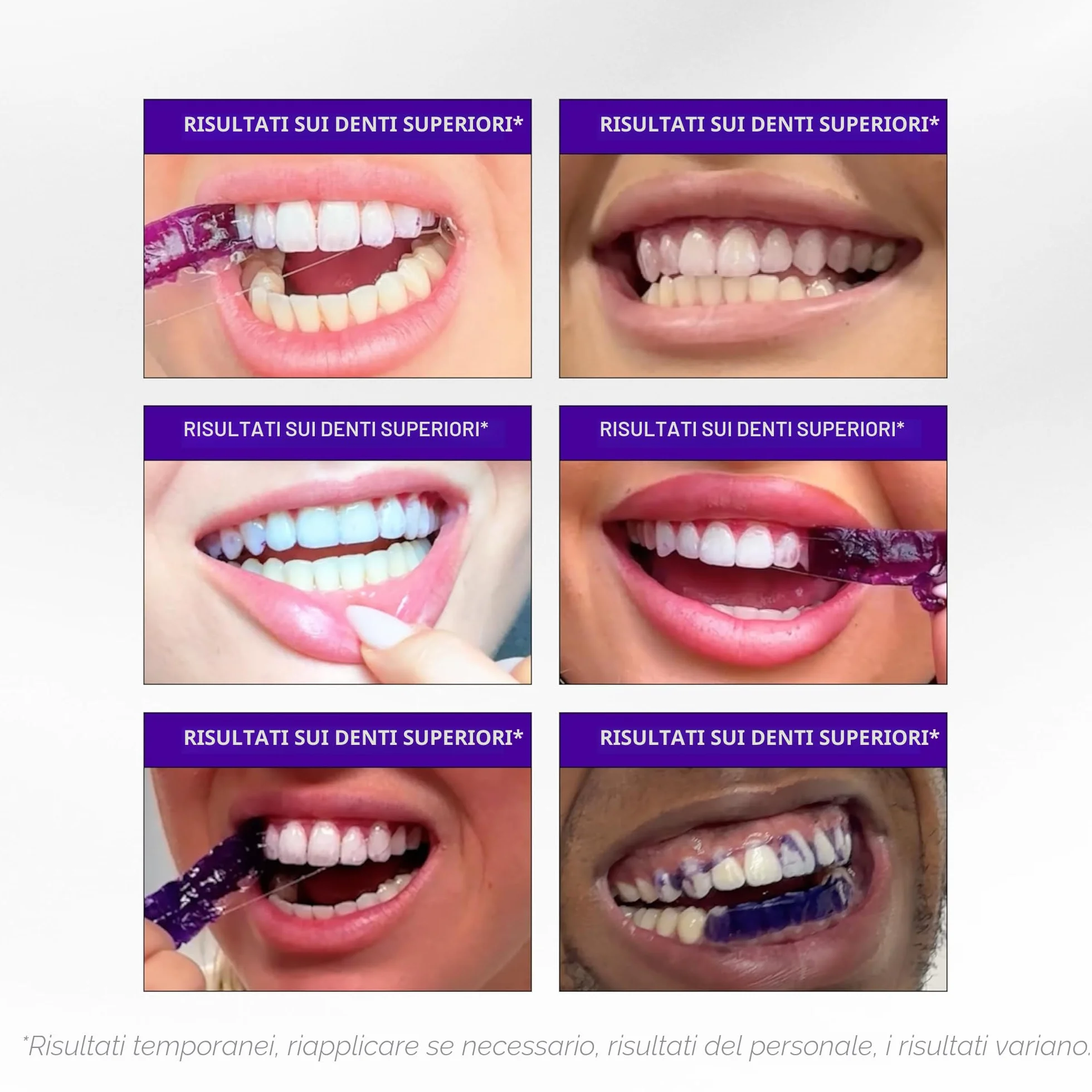 Hismile V34 Strisce Sbiancanti, Sbiancamento dei Denti, 14 Pezzi