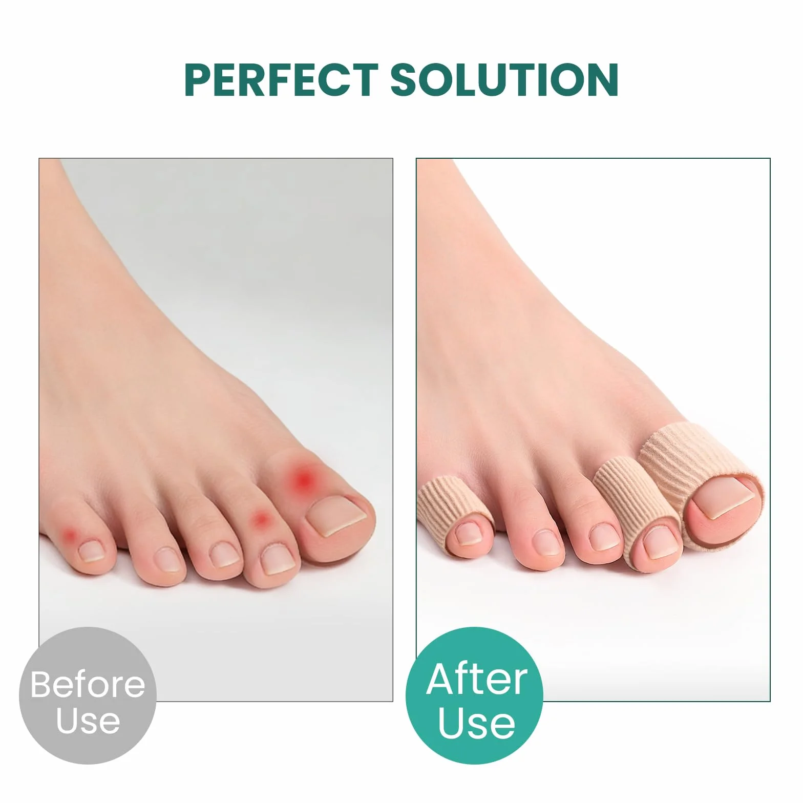 Welnove Toe Cushion Tube Sleeves 18 pezzi protezioni per dita dei piedi calli vesciche duroni taglia grande beige