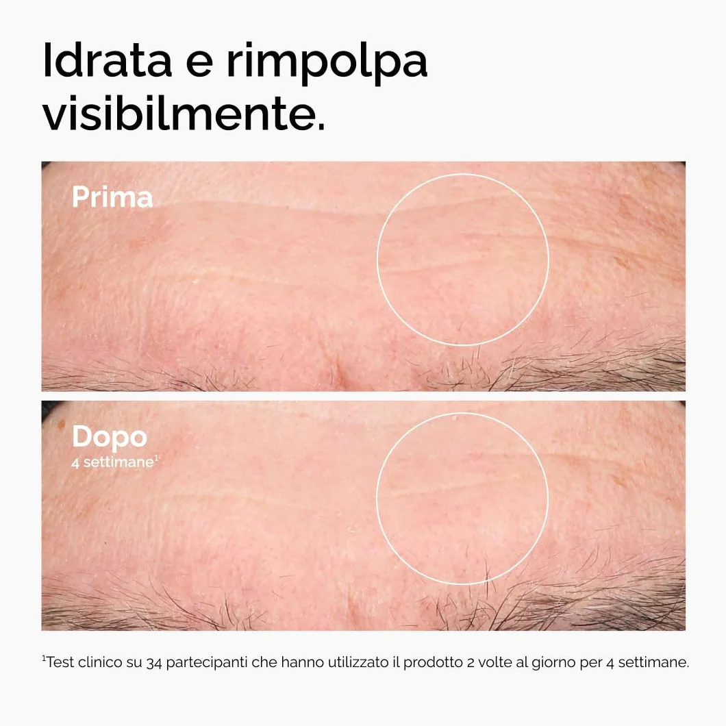 The Ordinary Hyaluronic Acid 2% + B5 30ml Siero Idratante Multi-Strato