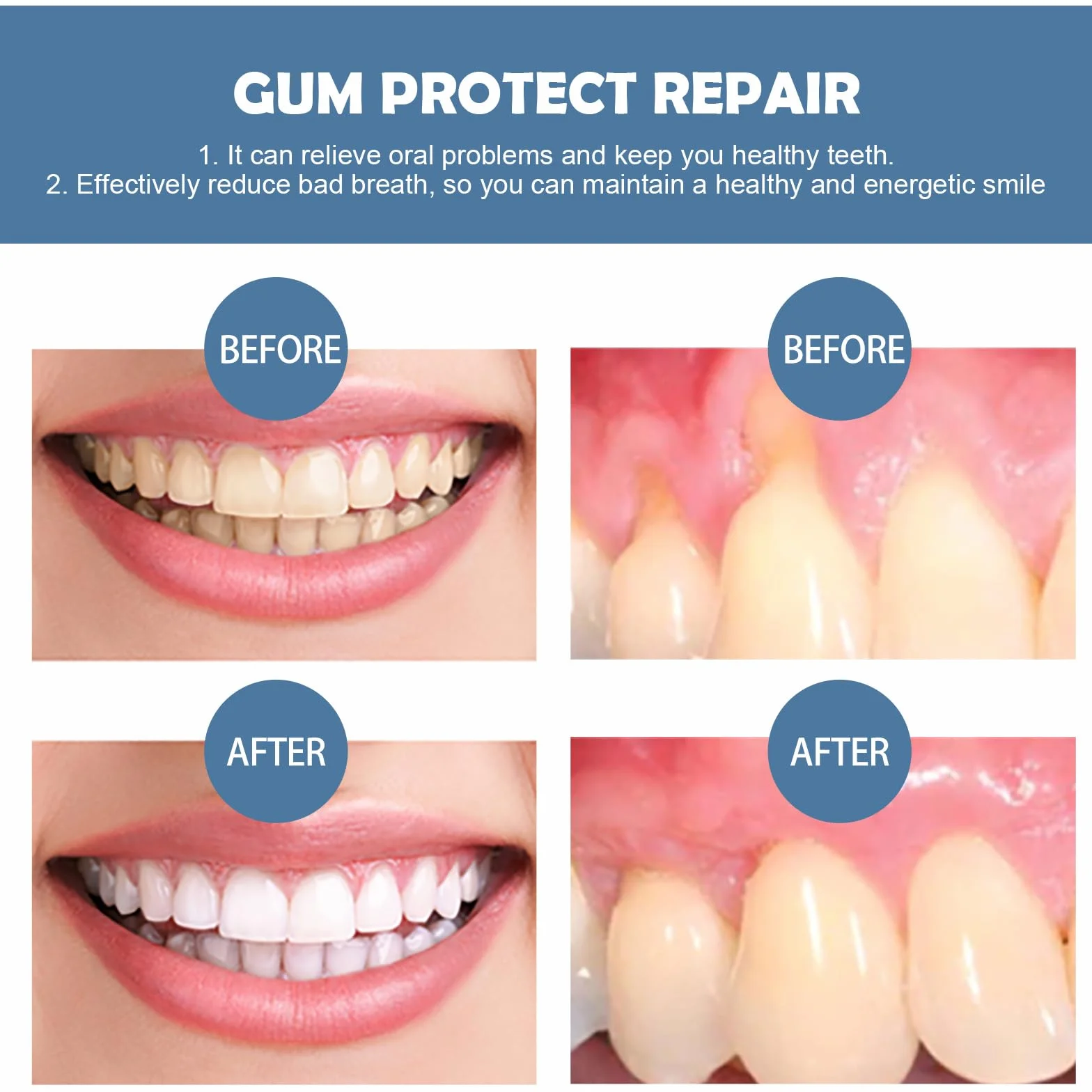 Gel per la cura delle gengive trattamento gengivale dentale rigenerante