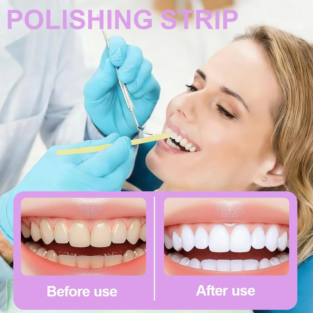 Strisce Abrasive Interdentali 20μm 30μm 50μm Carta Vetrata per Dentisti