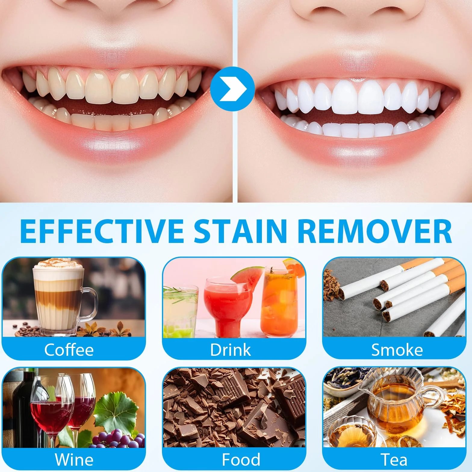 Kit sbiancante per denti, 10 gel sbiancanti ad azione rapida, 2 parentesi graffe, sbiancamento domestico