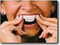 Boolavard 4 vassoi sbiancamento denti gel bleach thermo gum shield