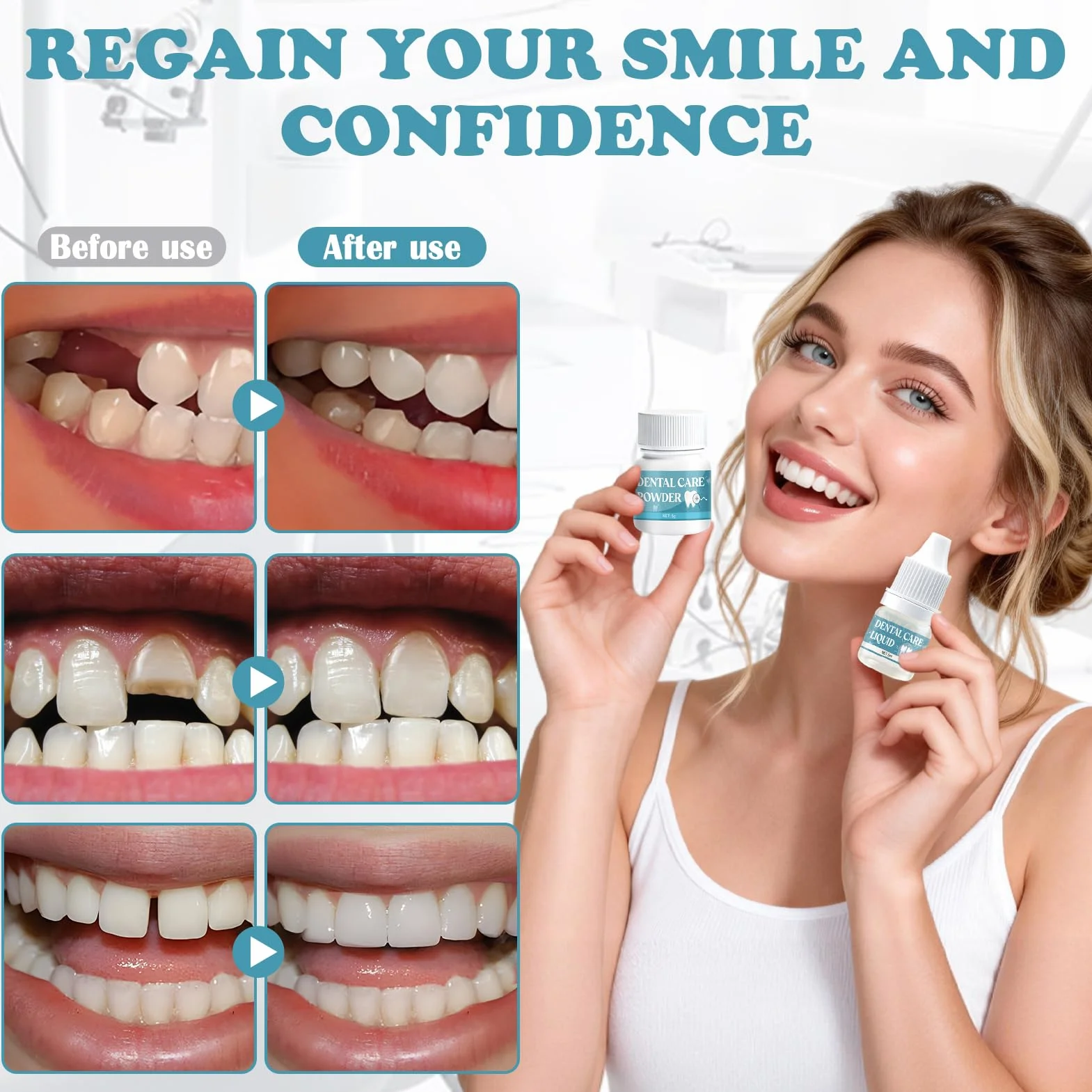 Cemento Dentale Definitivo per Ponti, Capsule e Denti a Perno