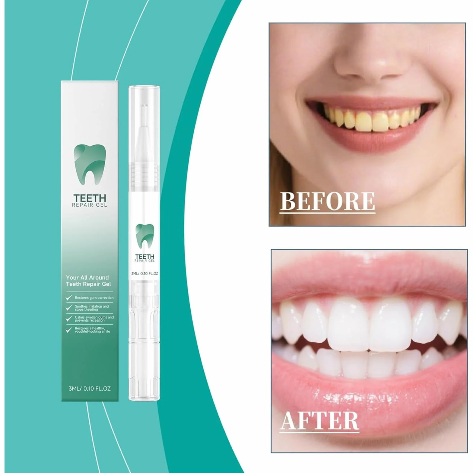 Gel riparazione denti, kit riparazione gengive, penna sbiancante denti, smacchiatore, protezione gengive