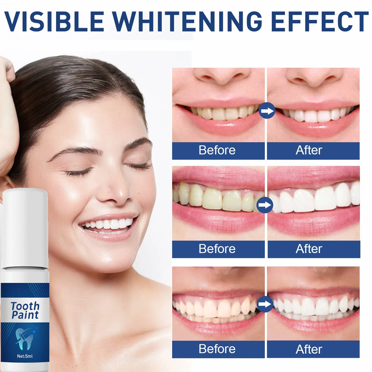 Teeth Whitening Paint, Teeth Stain Remover, Instant Whitening Gel (5Pcs)