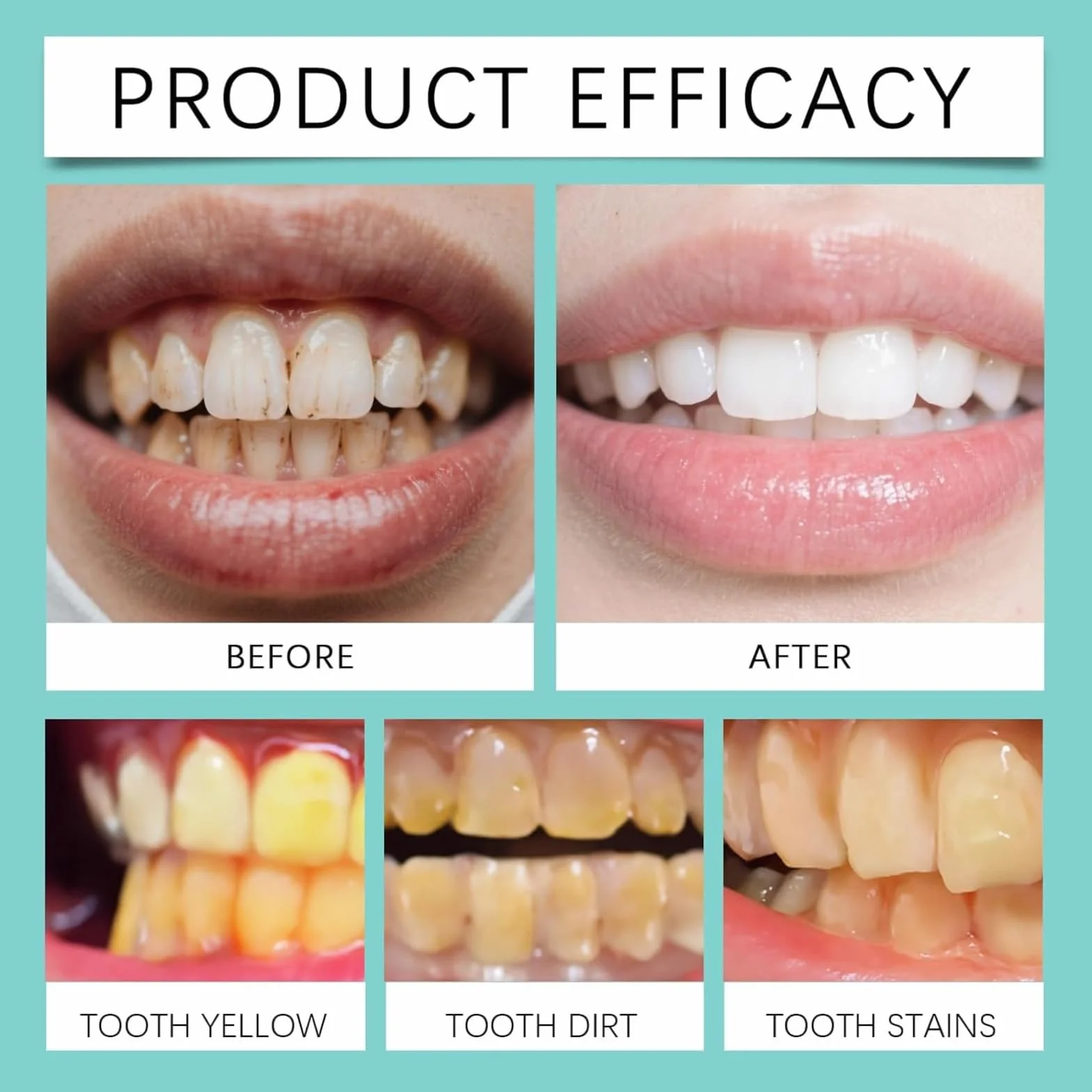Gel riparazione denti, kit riparazione gengive, penna sbiancante denti, smacchiatore, protezione gengive