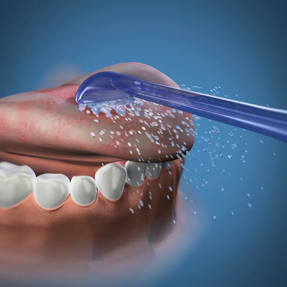 Waterpik TC-100E Testine Raschietto Lingua per Idropulsore, Confezione da 2