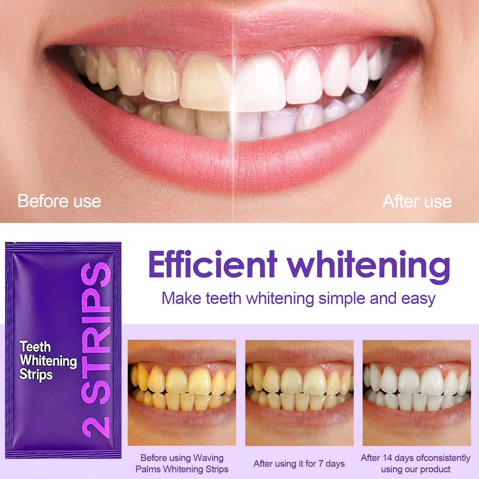 Professionale Strisce Sbiancanti Denti Viola, Rimuovere Macchie, Sorriso Bianco