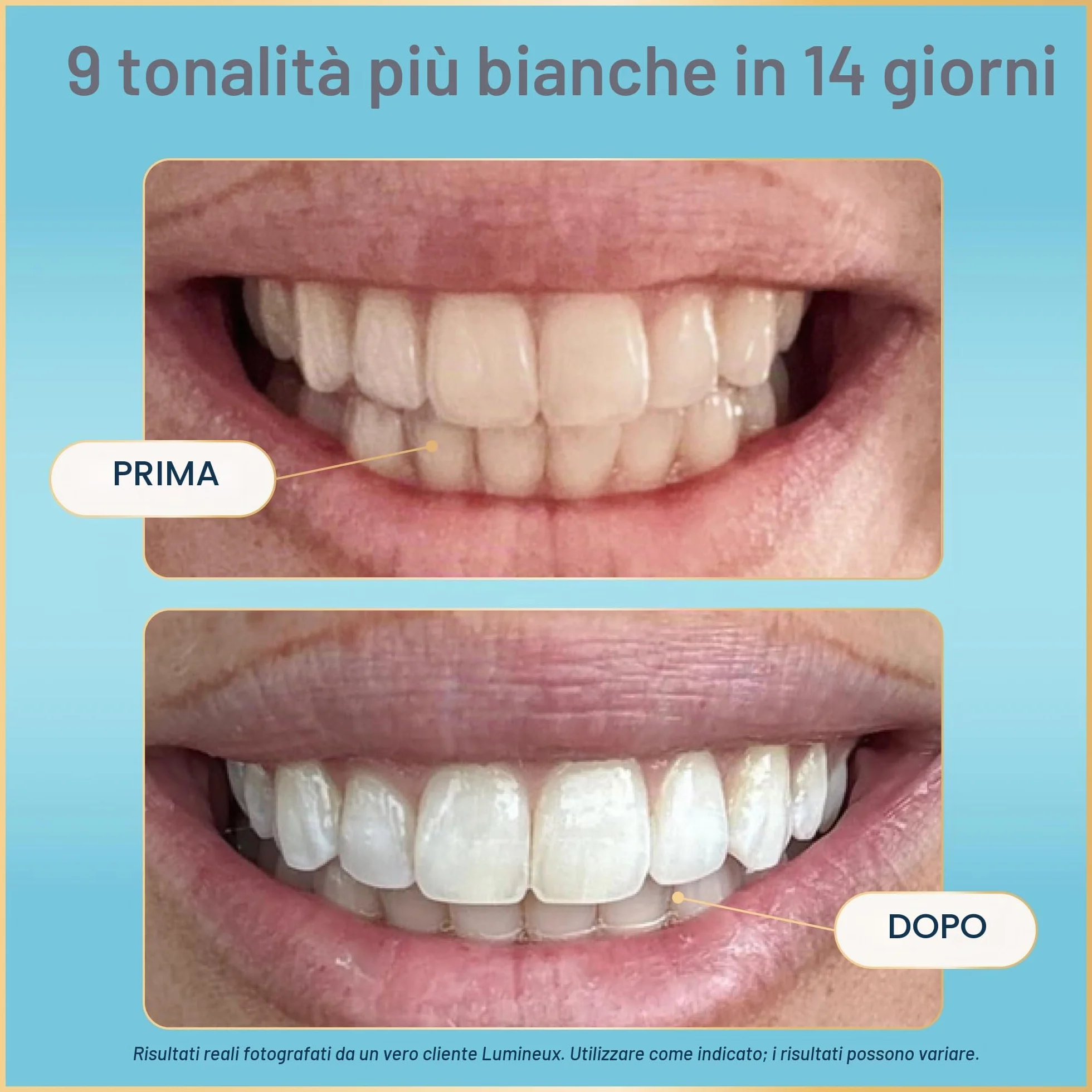 Oral Essentials Lumineux Strisce Sbiancanti Per Denti 21 Trattamenti Non Tossici Senza Sensibilità