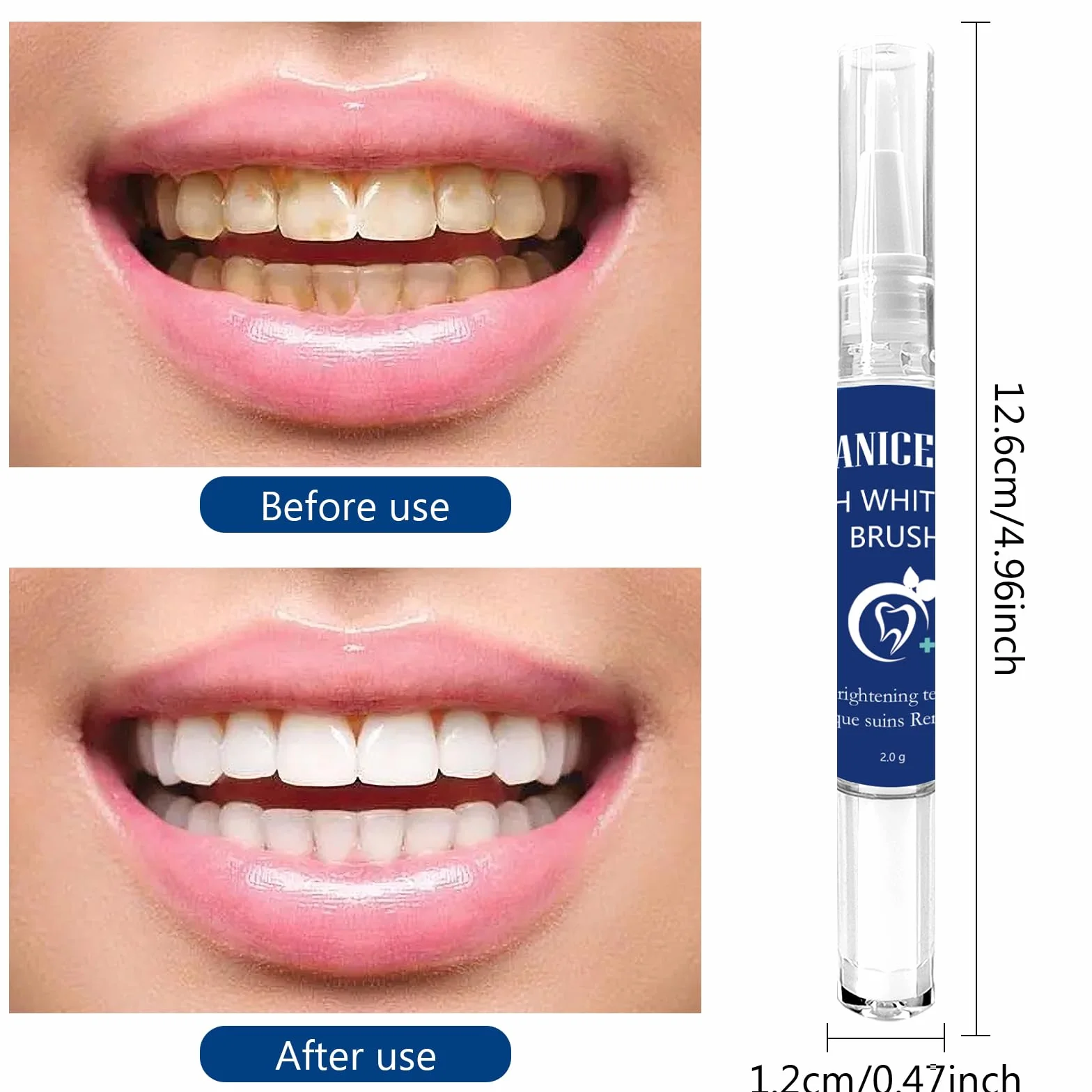 Penna Sbiancante Denti Professionale 2 Pezzi, Gel Sbiancante Rimuove Macchie Dentali