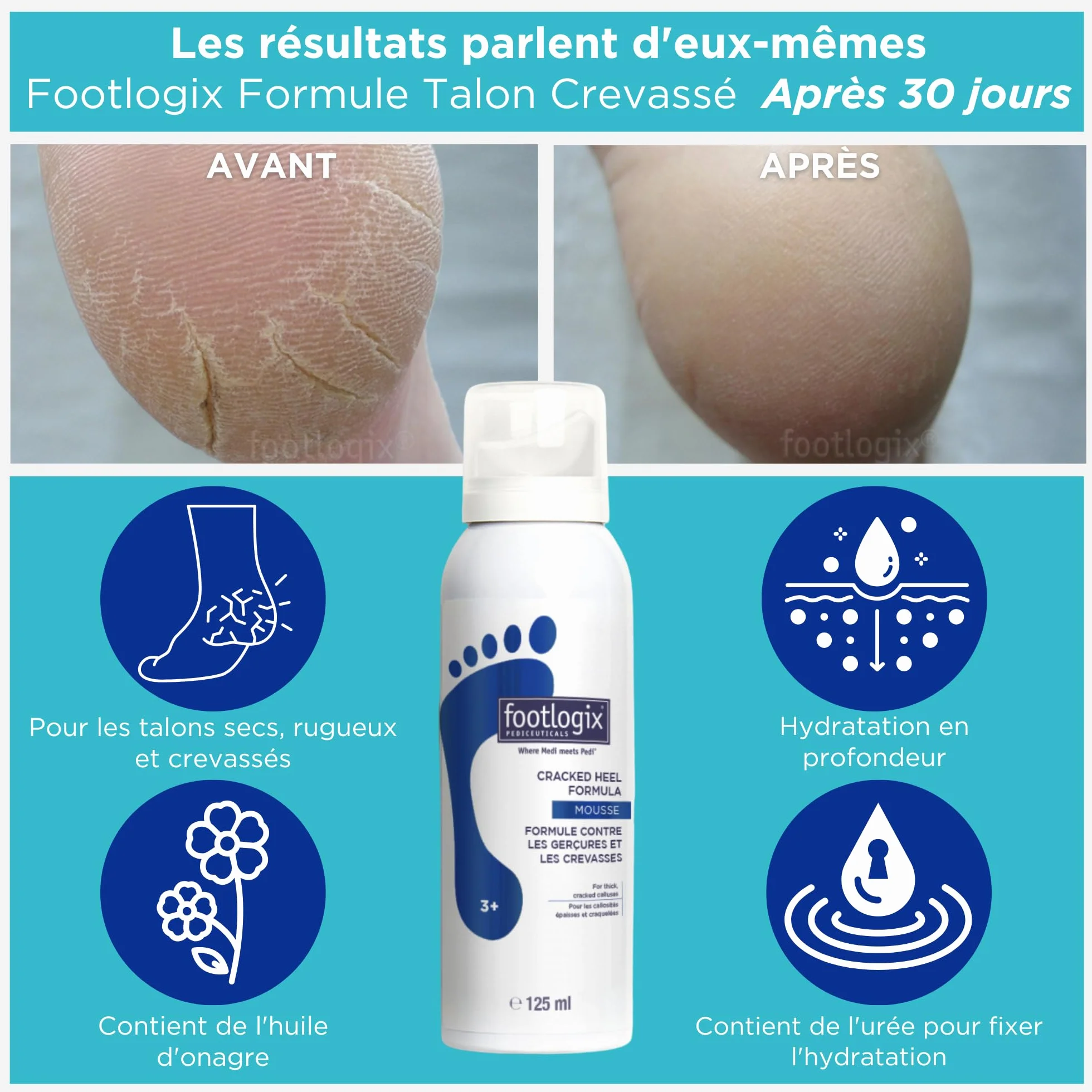 Footlogix Cracked Heel Formula