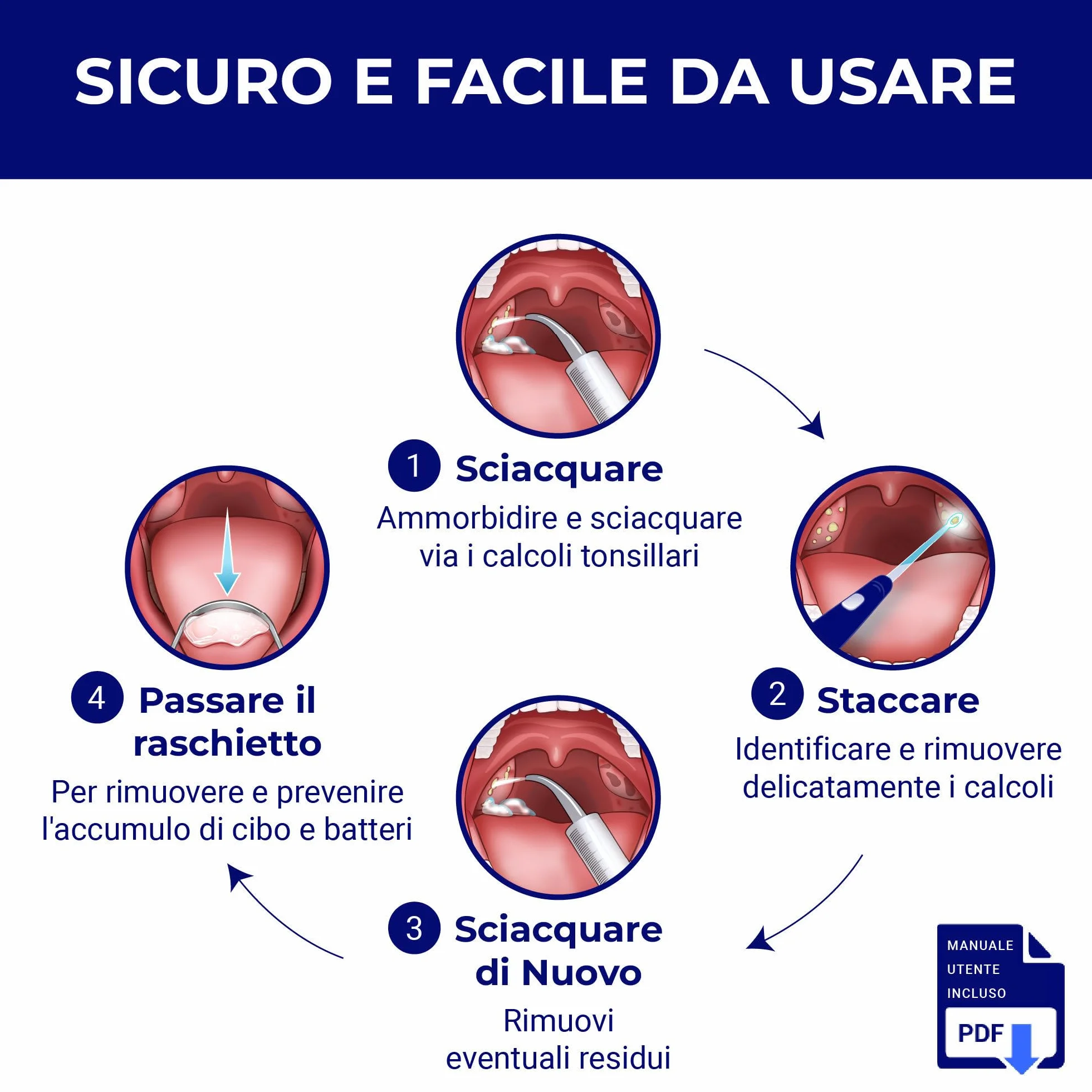 ORAVIX Kit per rimuovere calcoli tonsillari con luce LED, 3 beccucci, siringa e raschietto per lingua