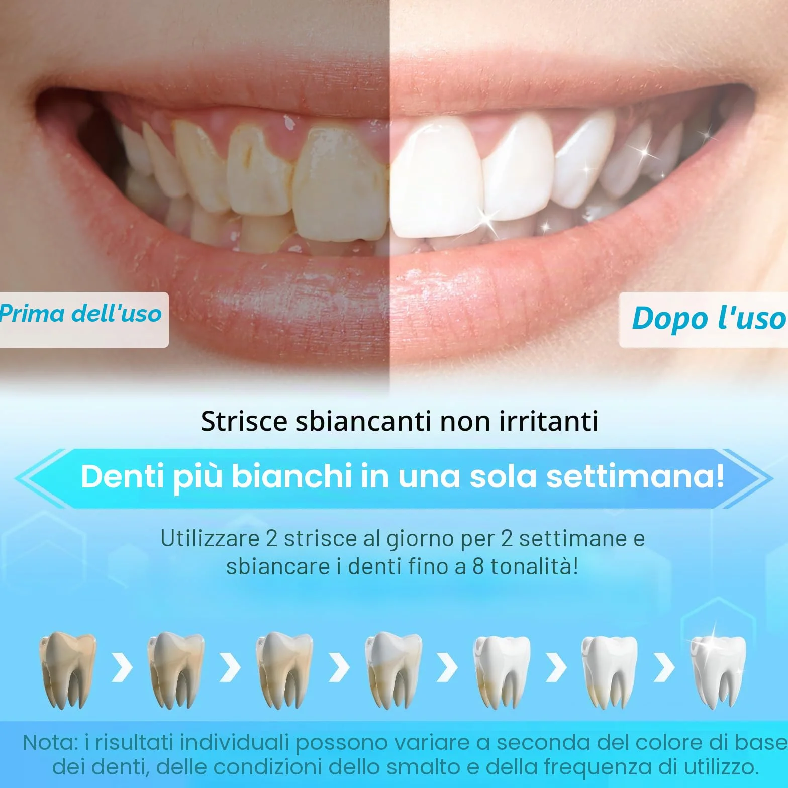 SURFOU Kit Strisce Sbiancanti Denti 56 Pezzi - Teeth Whitening Strips Professionale, Sbiancamento Rapido e Delicato, Senza Perossido per Denti Sensibili