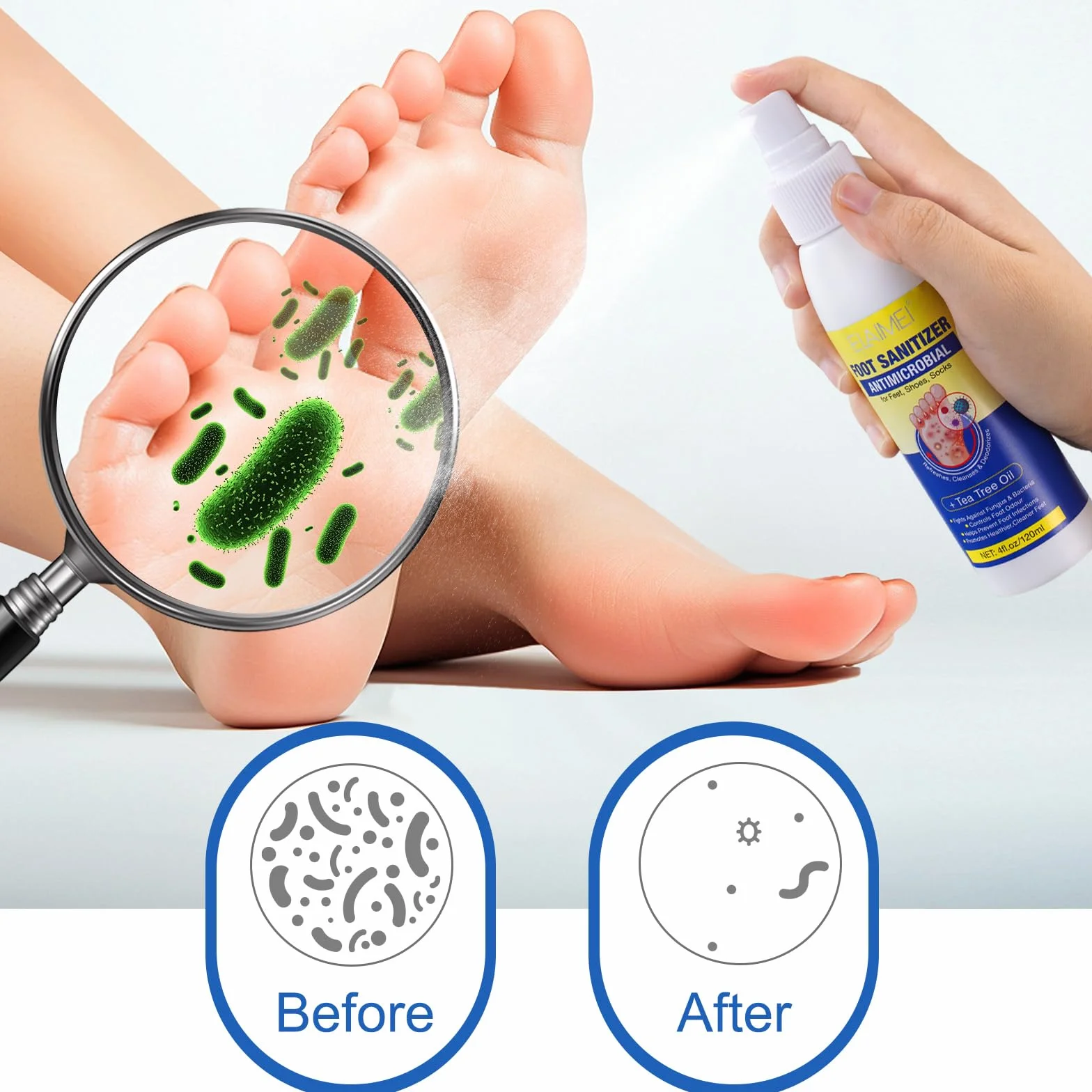 Olio Di Melaleuca Spray Antiodore Per I Piedi 120ml Prevenzione Piede D'Atleta Allevia Prurito