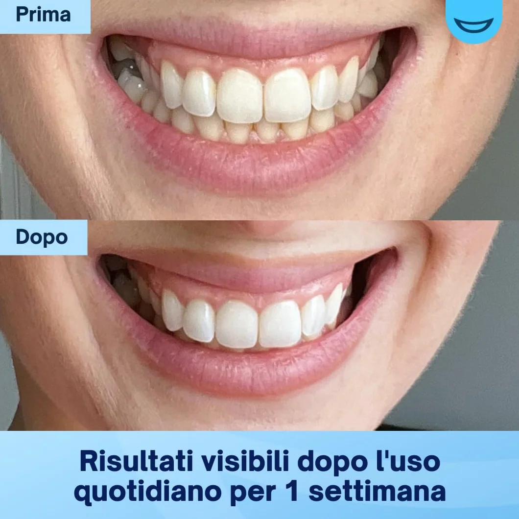 MySweetSmile Strisce sbiancanti per denti Pap - 42 senza perossido - 21 trattamenti - Gusto menta