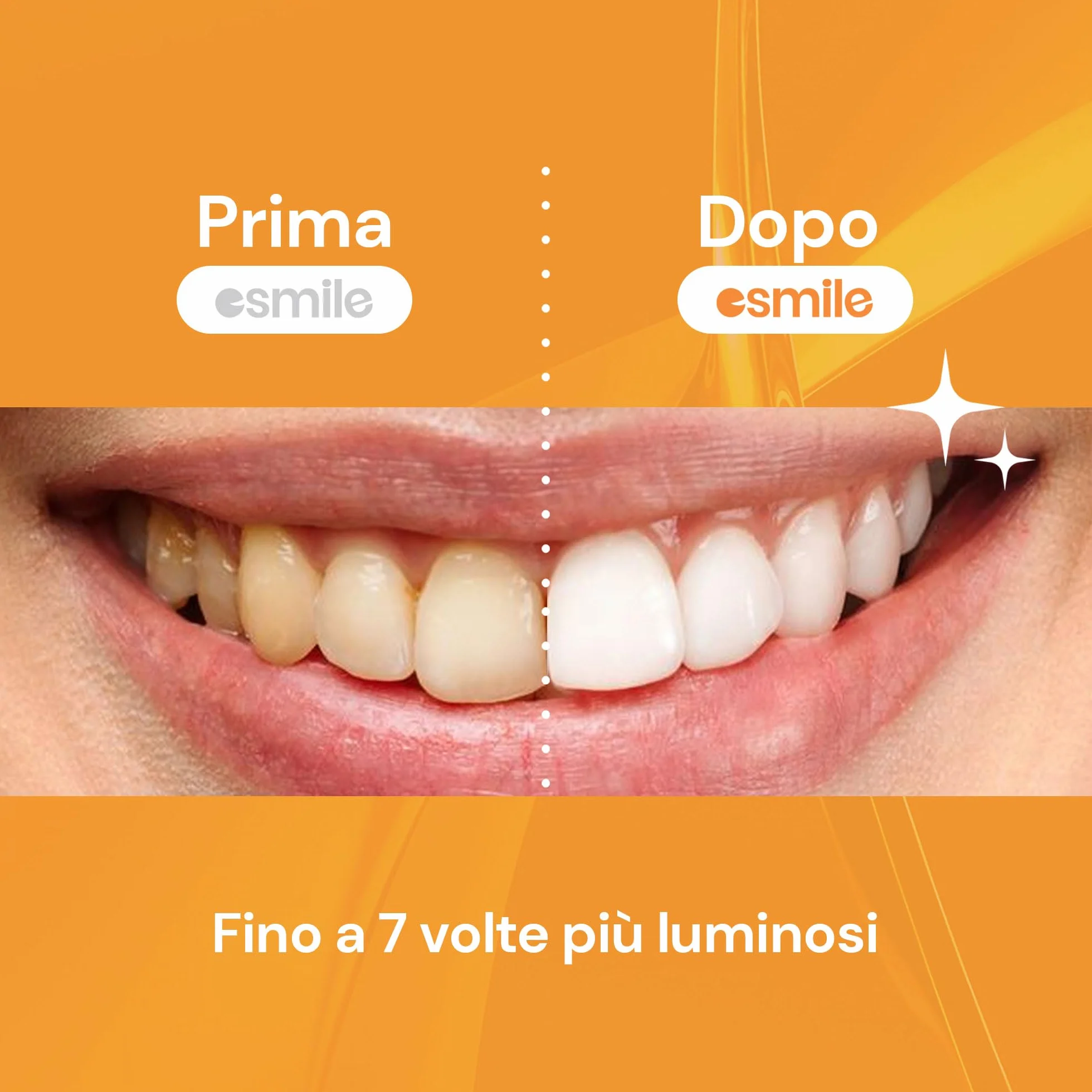 ESMILE 28 Strisce Sbiancanti Denti Frutta Pesca, Trattamento Professionale a Casa, 14 Trattamenti Igiene Orale