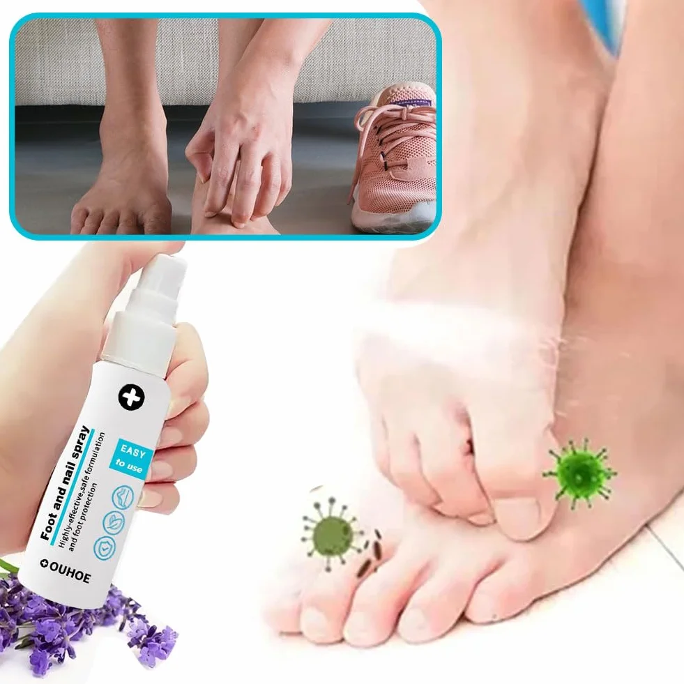 Spray Per Piedi E Unghie 2 Pcs Trattamento Del Piede Cura Dei Piedi 30ml
