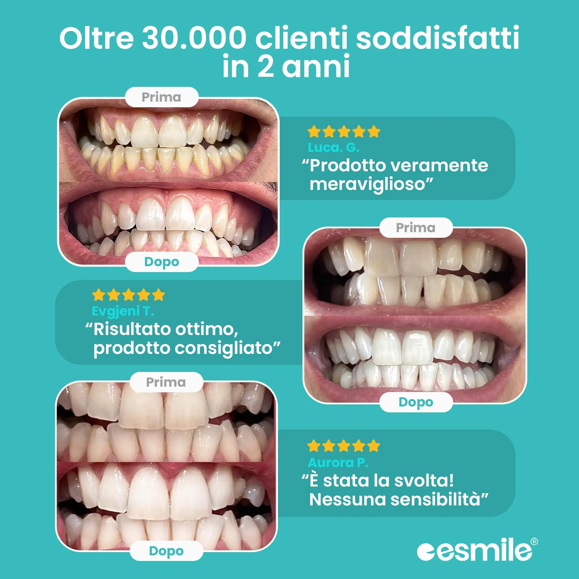 Esmile Kit Sbiancante Denti Professionale LED 16 Luci – Sbiancamento Istantaneo per Denti Sensibili