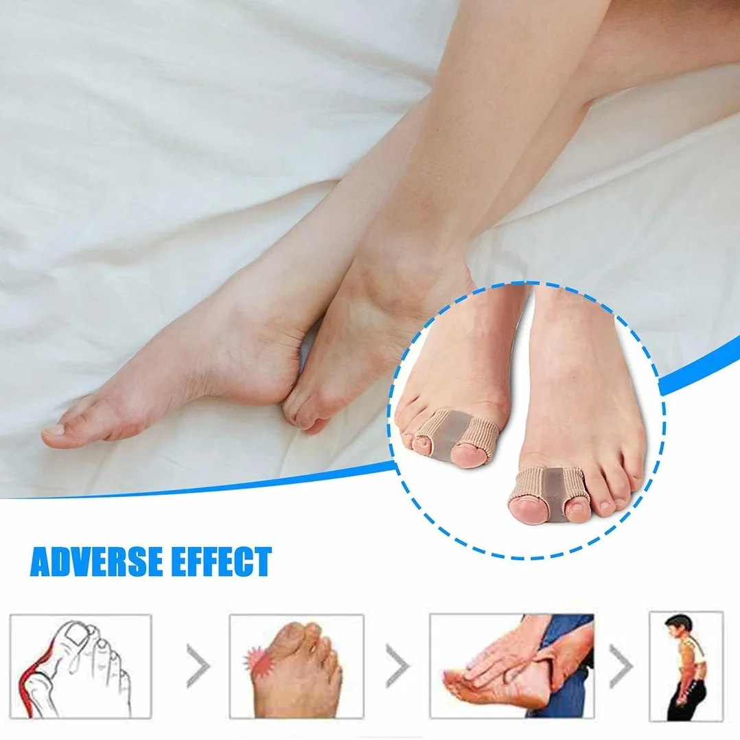 Separatori per Alluce Valgo per Dita Sovrapposte, 2Pcs Correttore in Gel per Donna Uomo